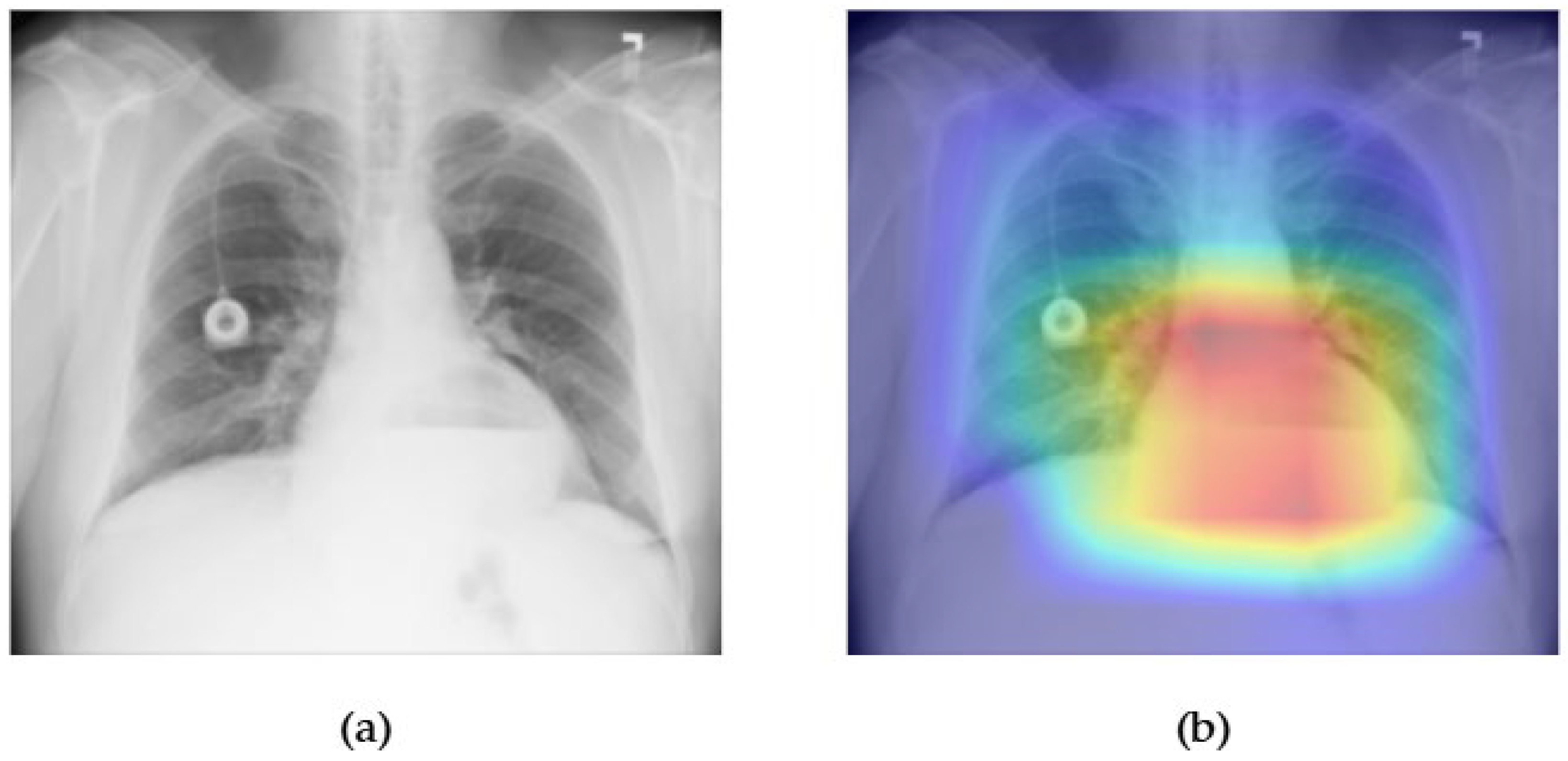 Diagnostics 15 02215 g025