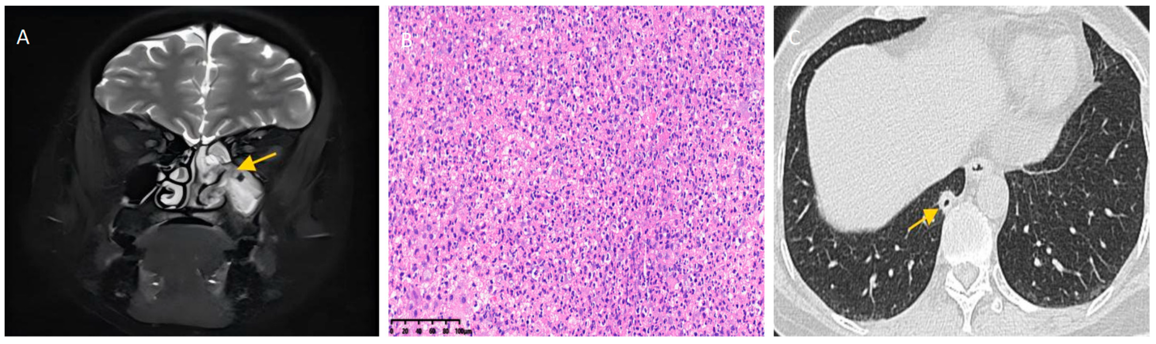 Diagnostics 15 02218 g002 Diagnostics 15 02218 g002