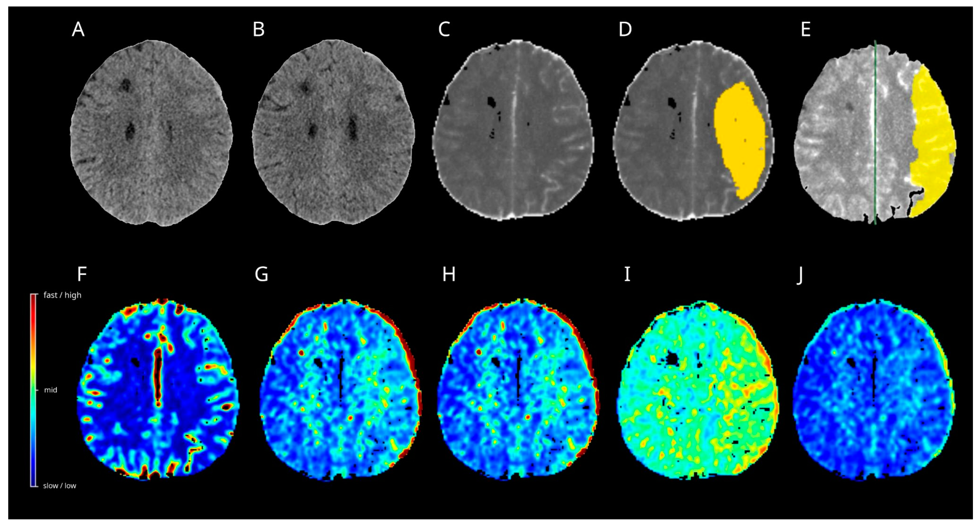 Diagnostics 15 02236 g005 Diagnostics 15 02236 g005