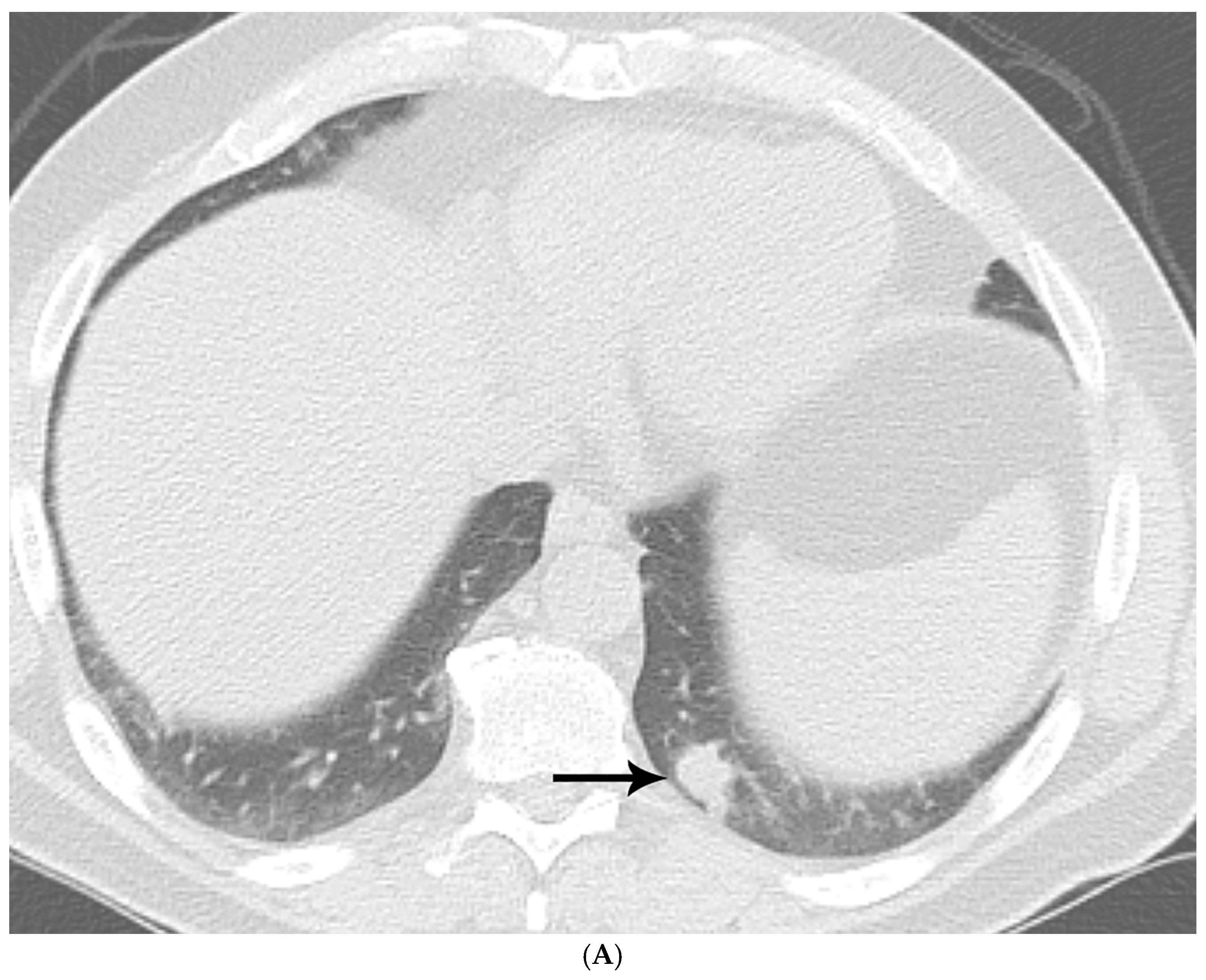 Diagnostics 15 02238 g001a