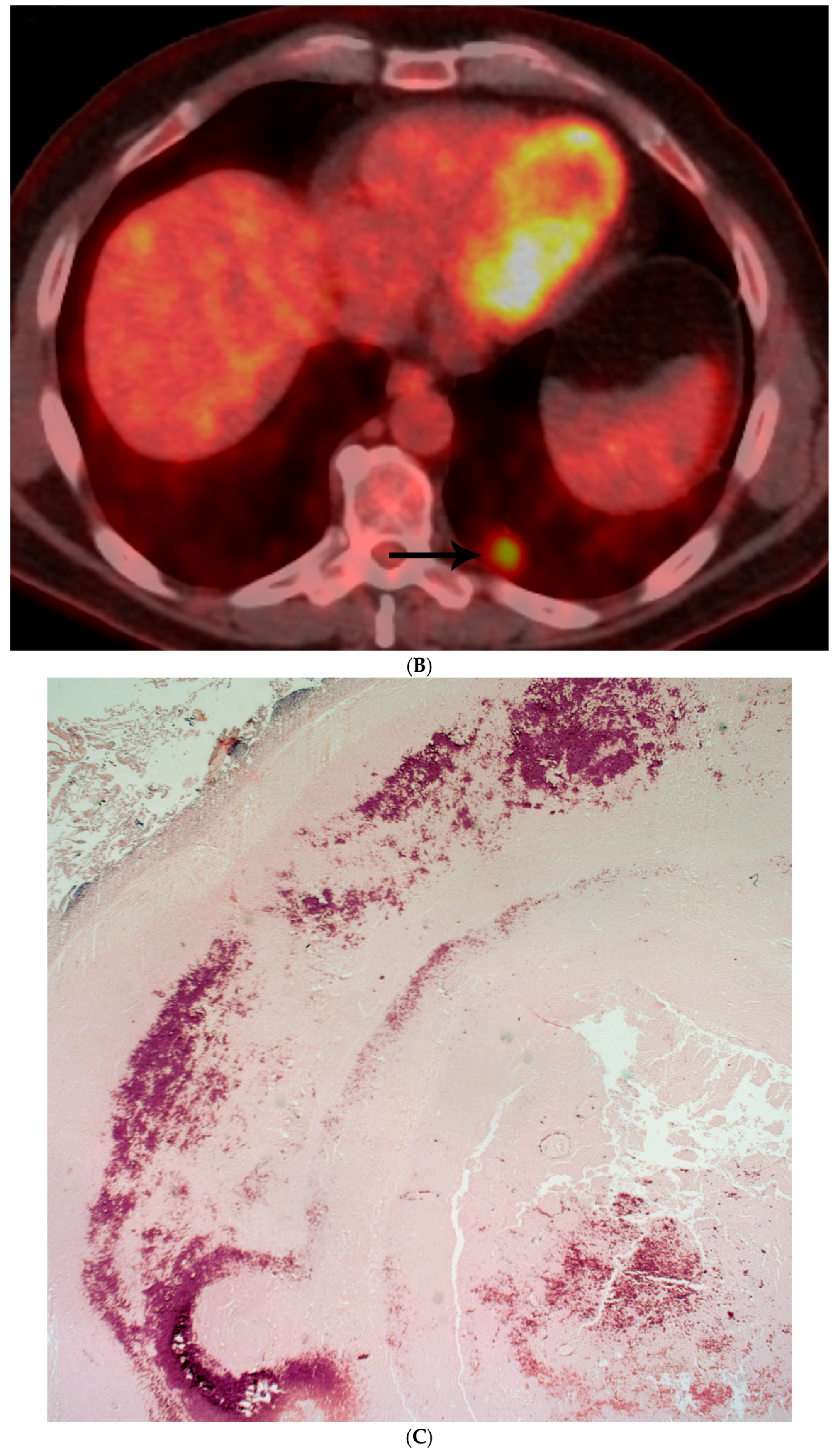 Diagnostics 15 02238 g001b