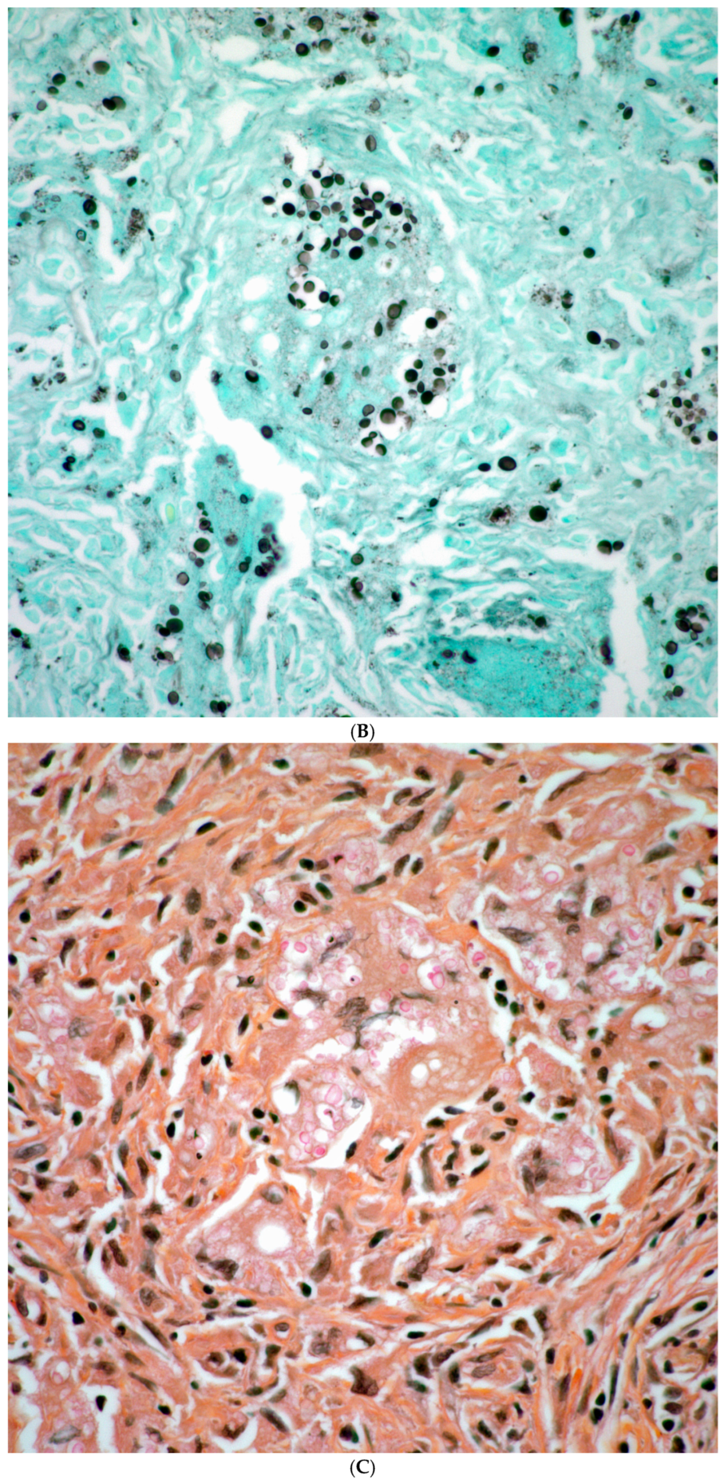 Diagnostics 15 02238 g002b