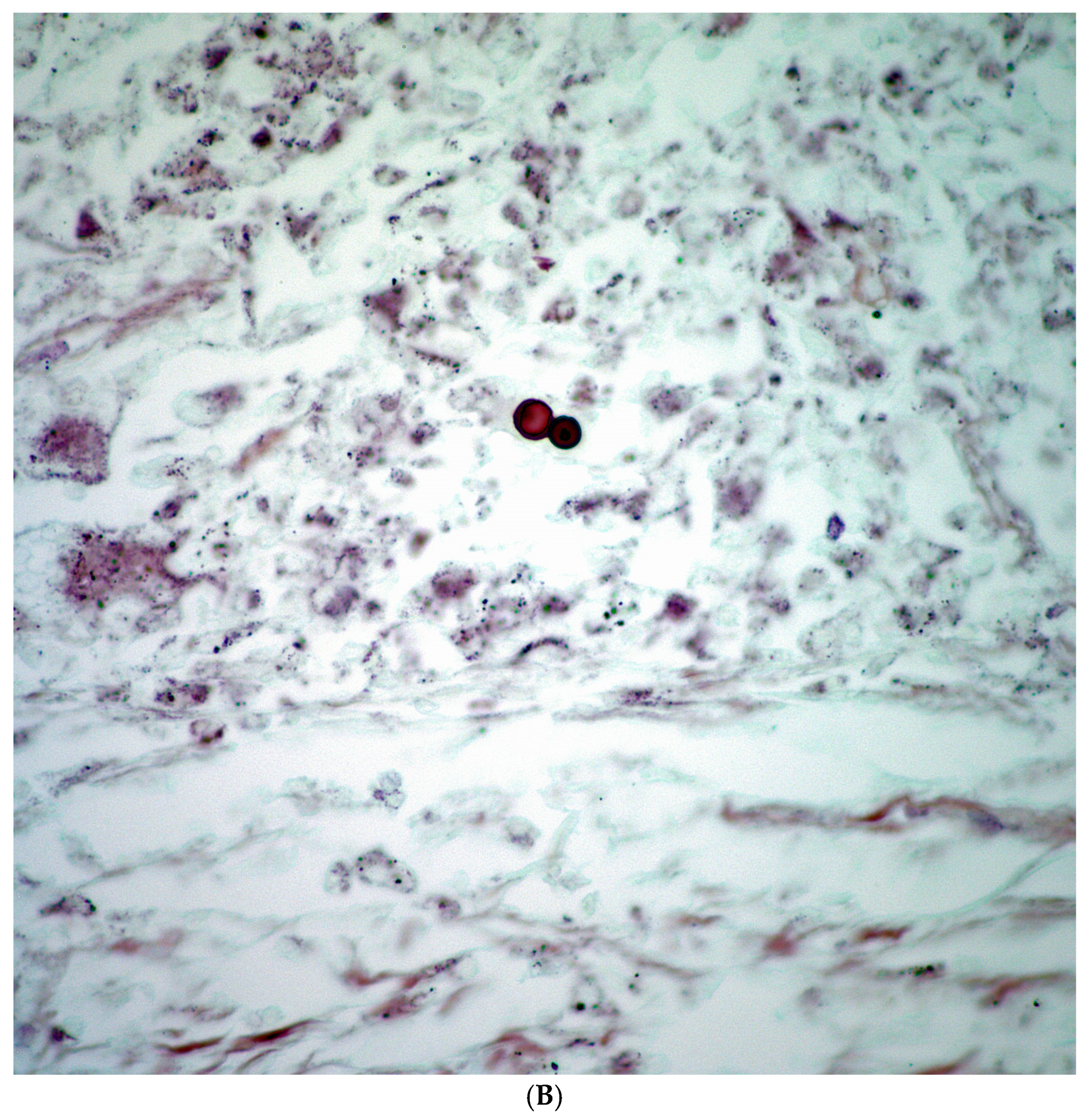 Diagnostics 15 02238 g004b