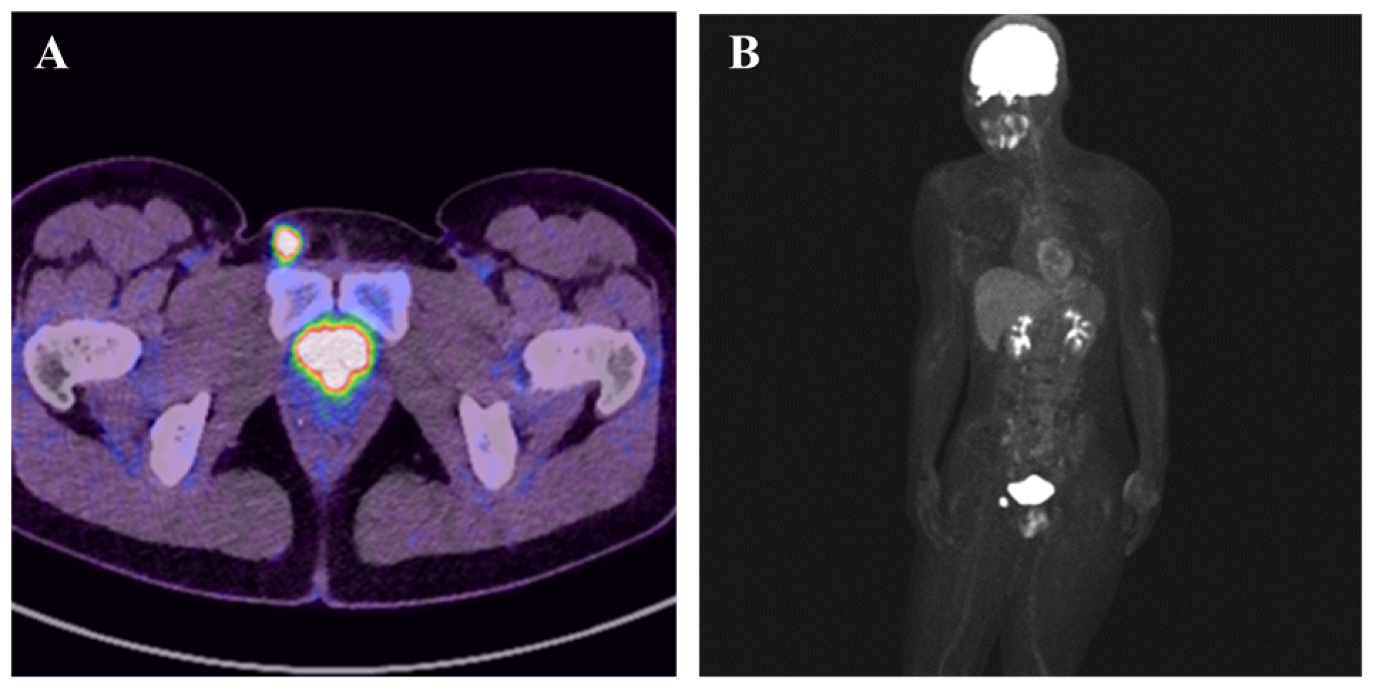 Diagnostics 15 02246 g002 Diagnostics 15 02246 g002
