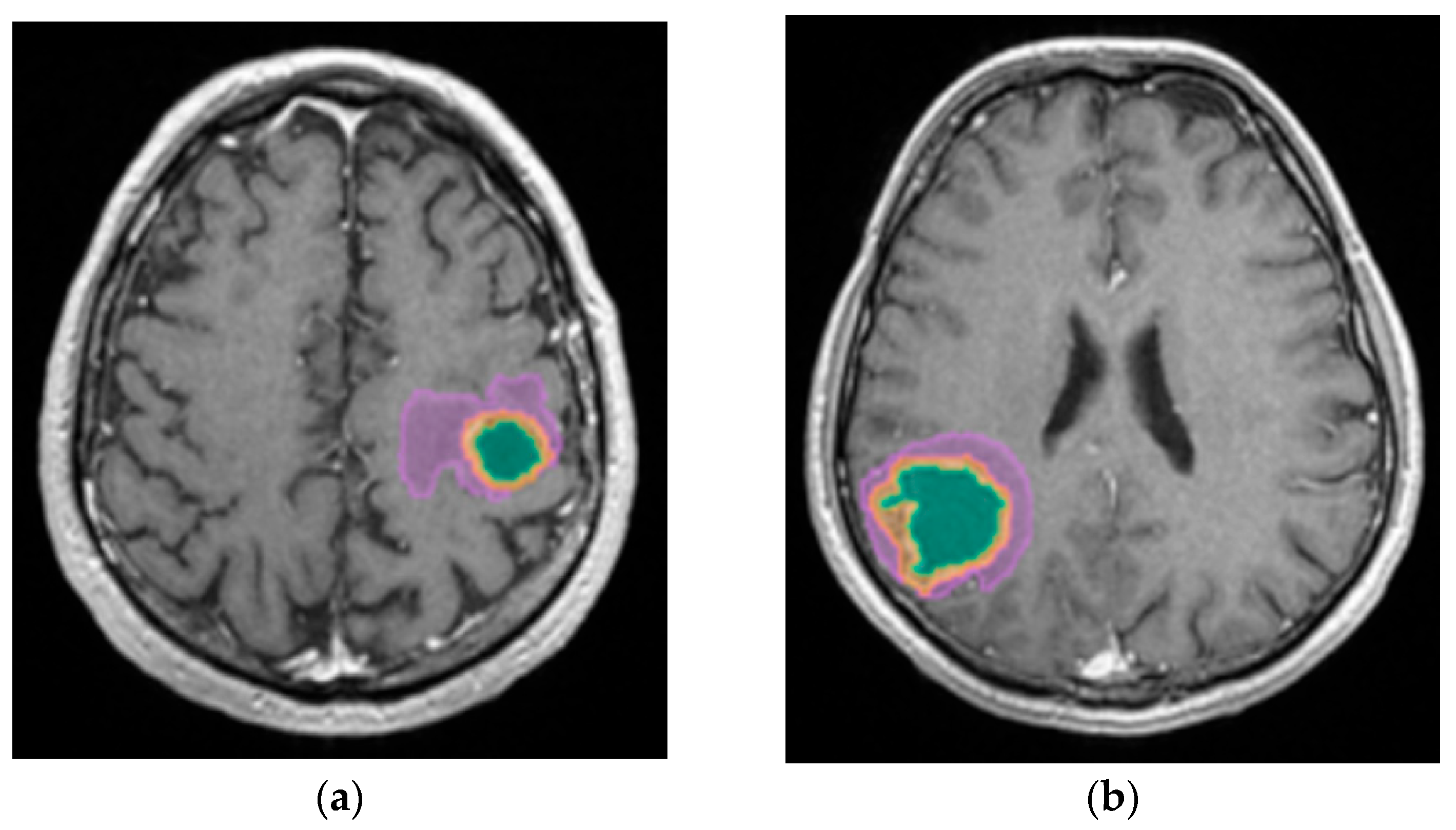Diagnostics 15 02248 g010