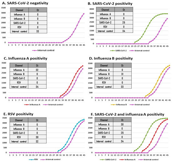 440×750+1000 -4000 Simultaneous Detection and Differentiation of SARS-CoV-2