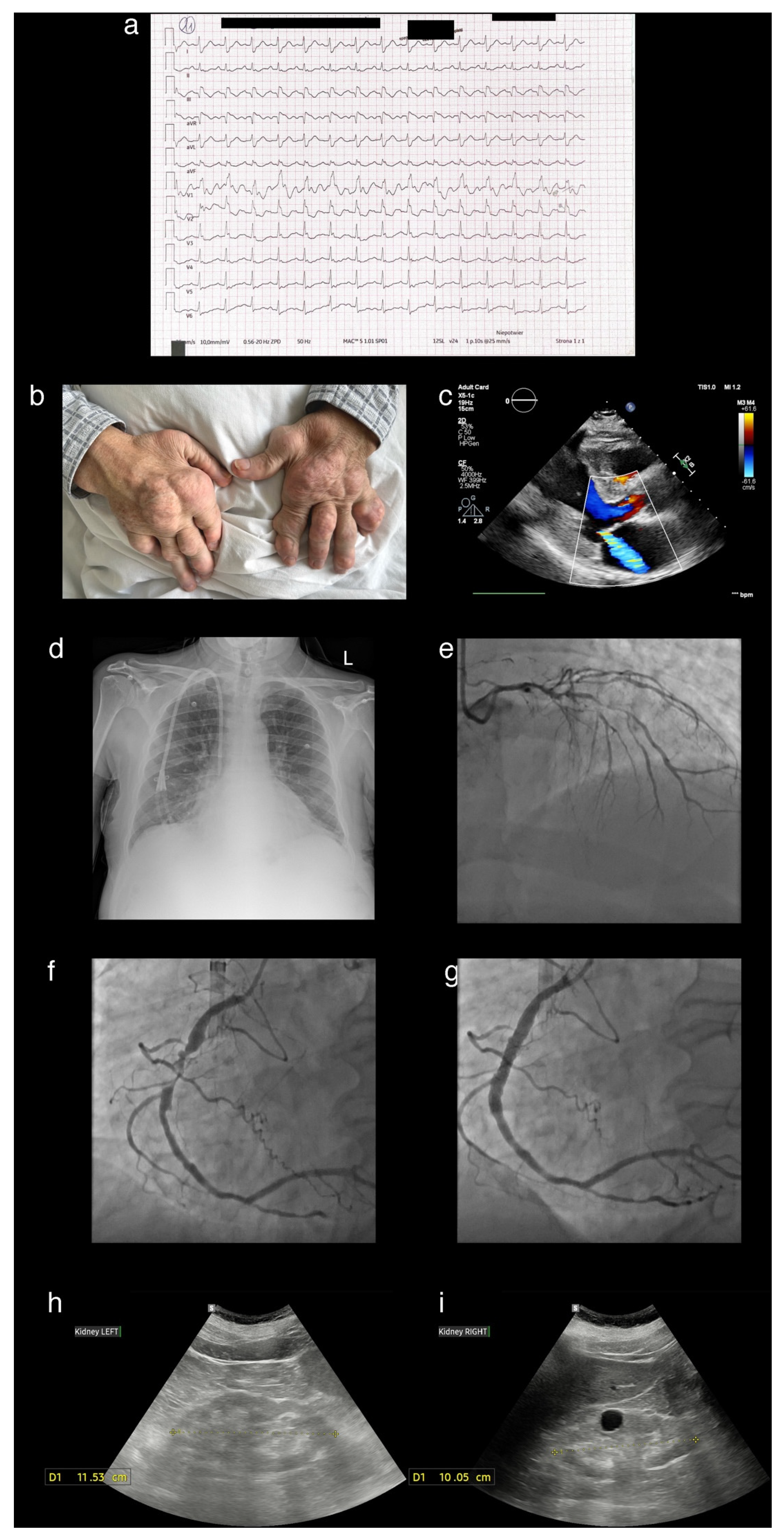 Diagnostics 15 02254 g001 Diagnostics 15 02254 g001