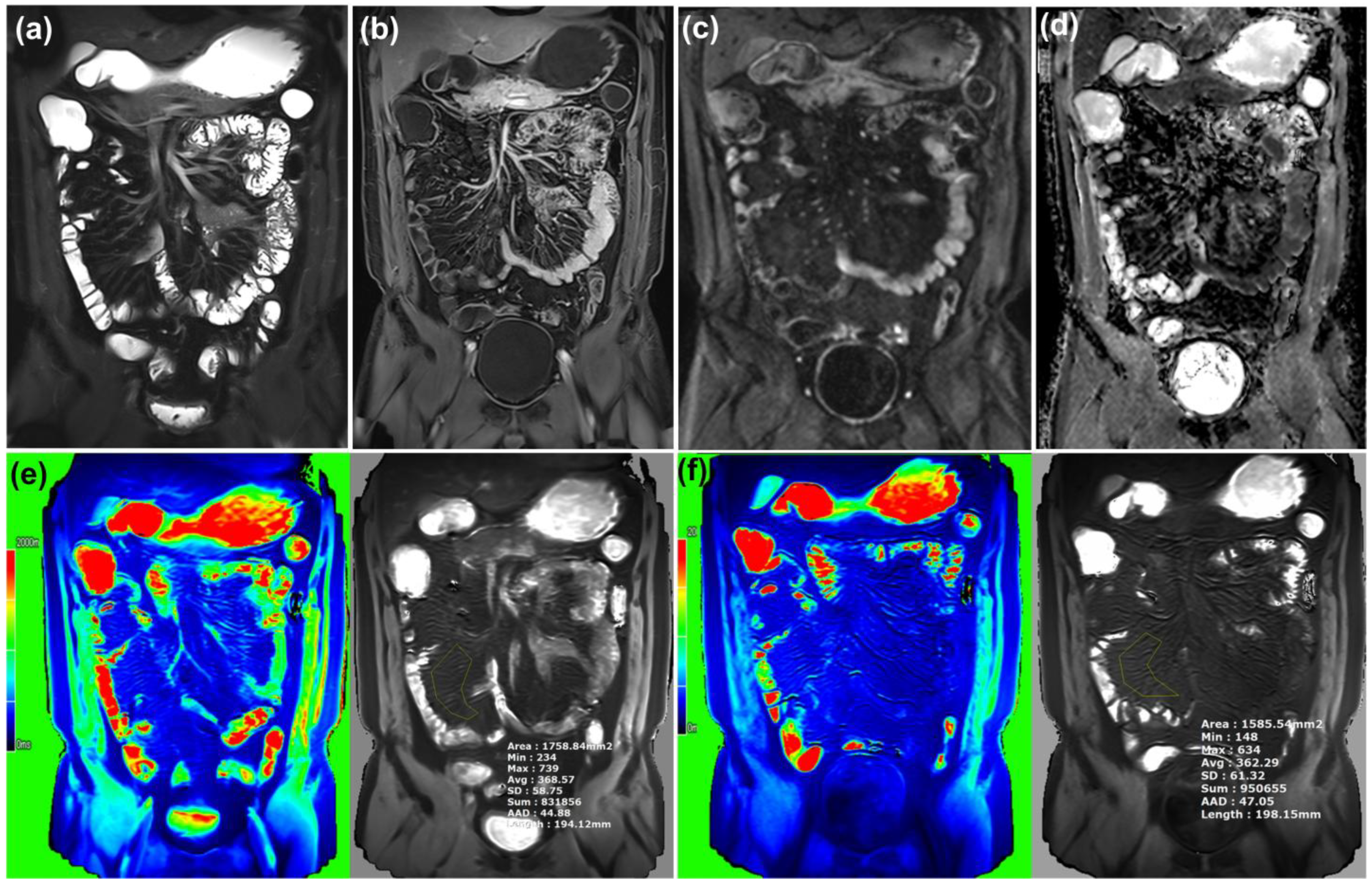 Diagnostics 15 02293 g002 Diagnostics 15 02293 g002
