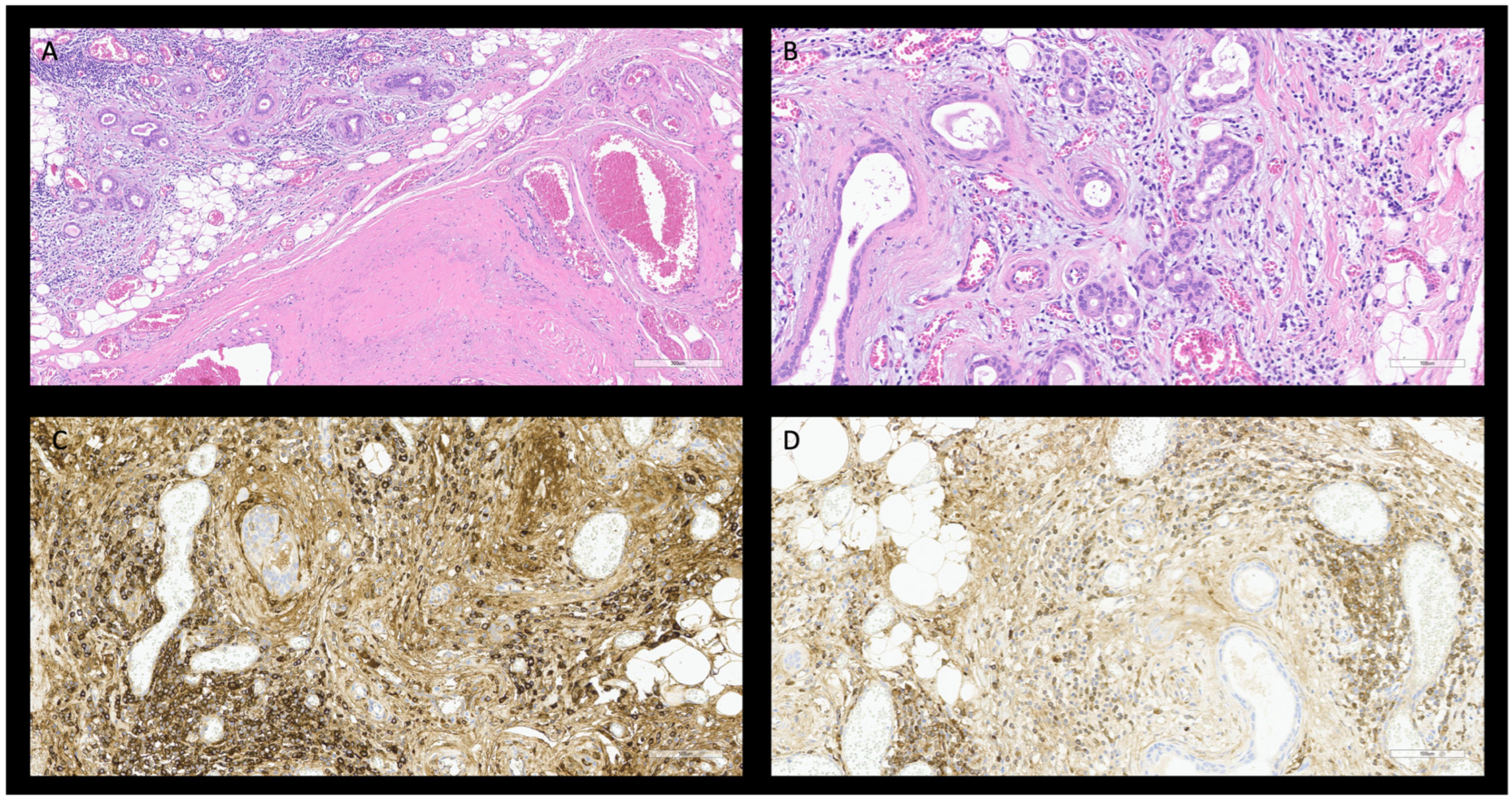 Diagnostics 15 02299 g003 Diagnostics 15 02299 g003