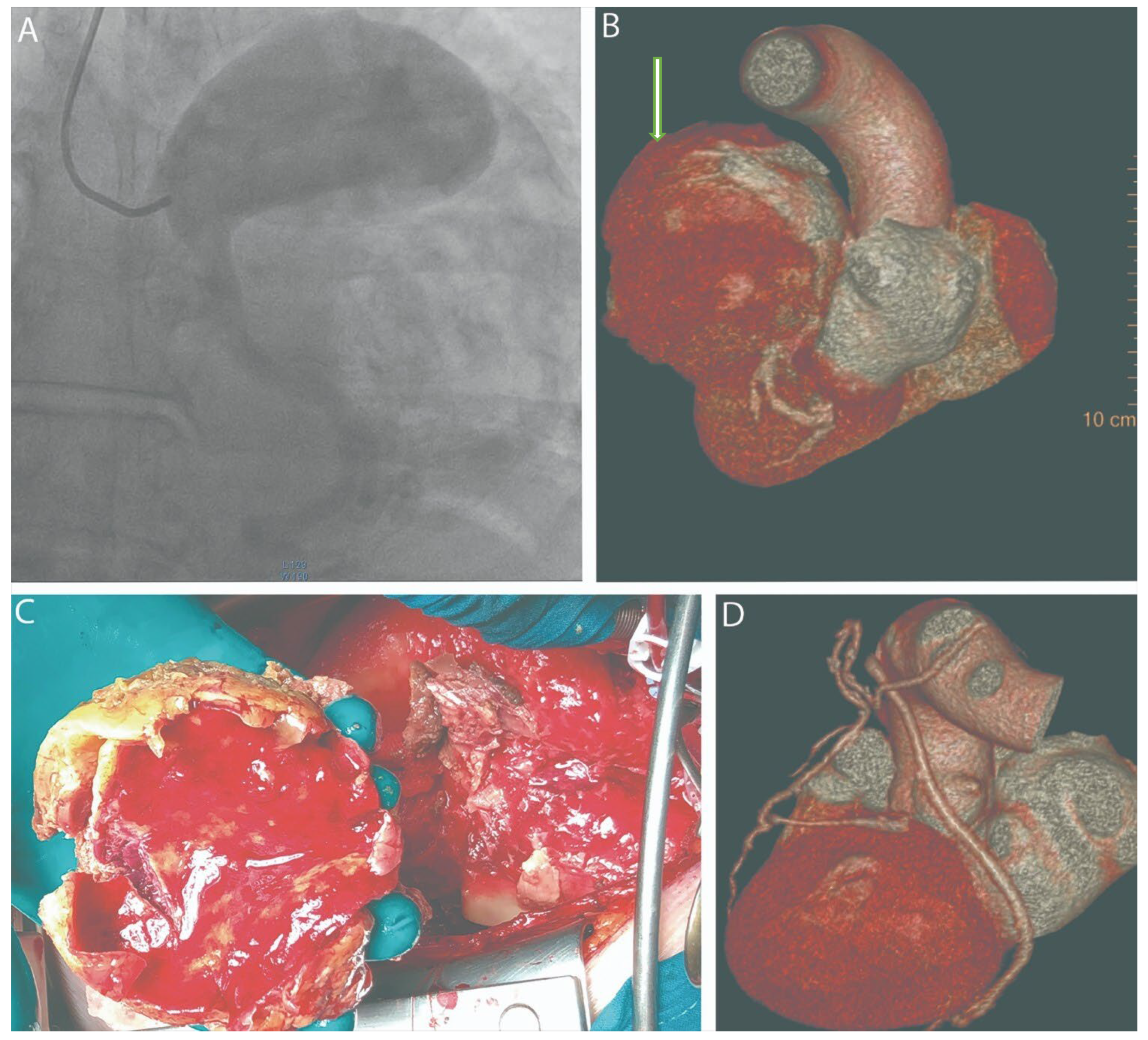 Diagnostics 15 02302 g001 Diagnostics 15 02302 g001