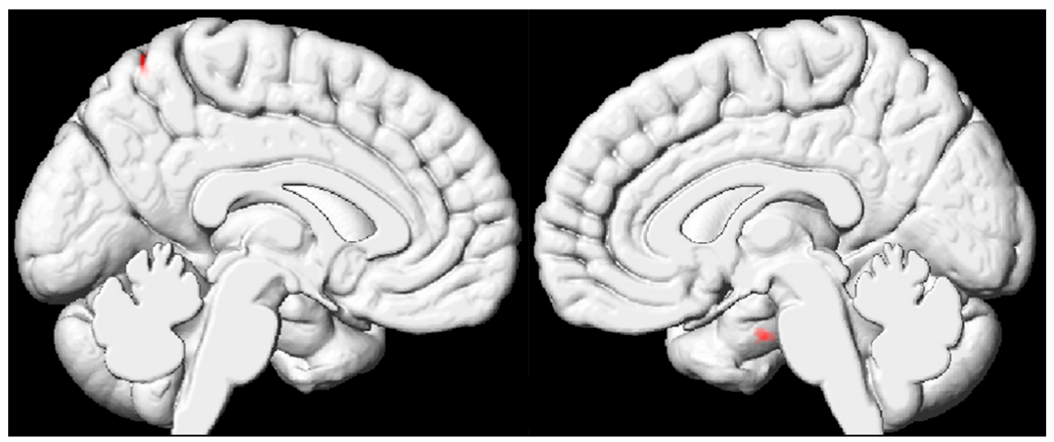 Diagnostics 15 02311 g003 Diagnostics 15 02311 g003