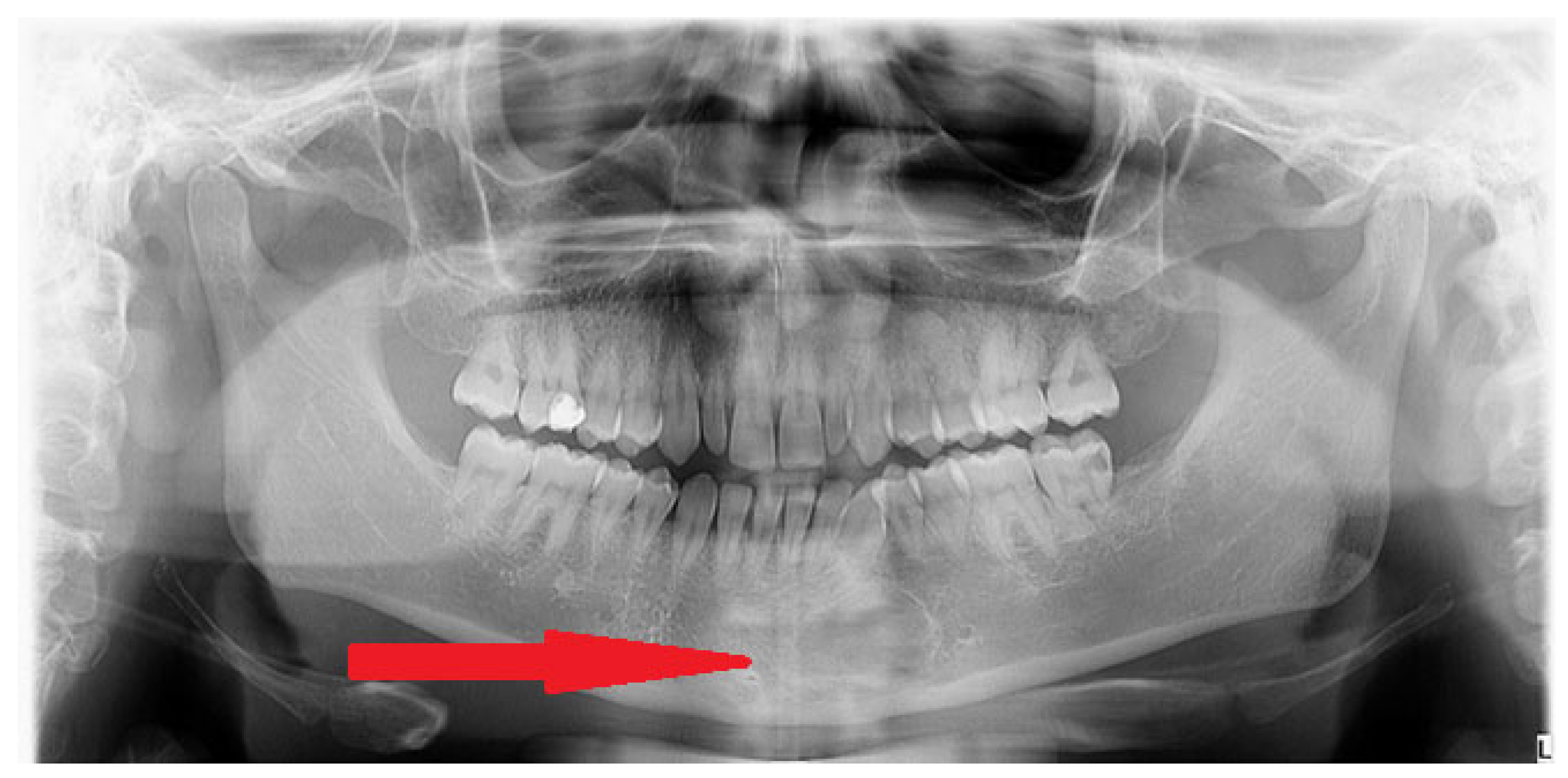 Diagnostics 15 02312 g001 Diagnostics 15 02312 g001