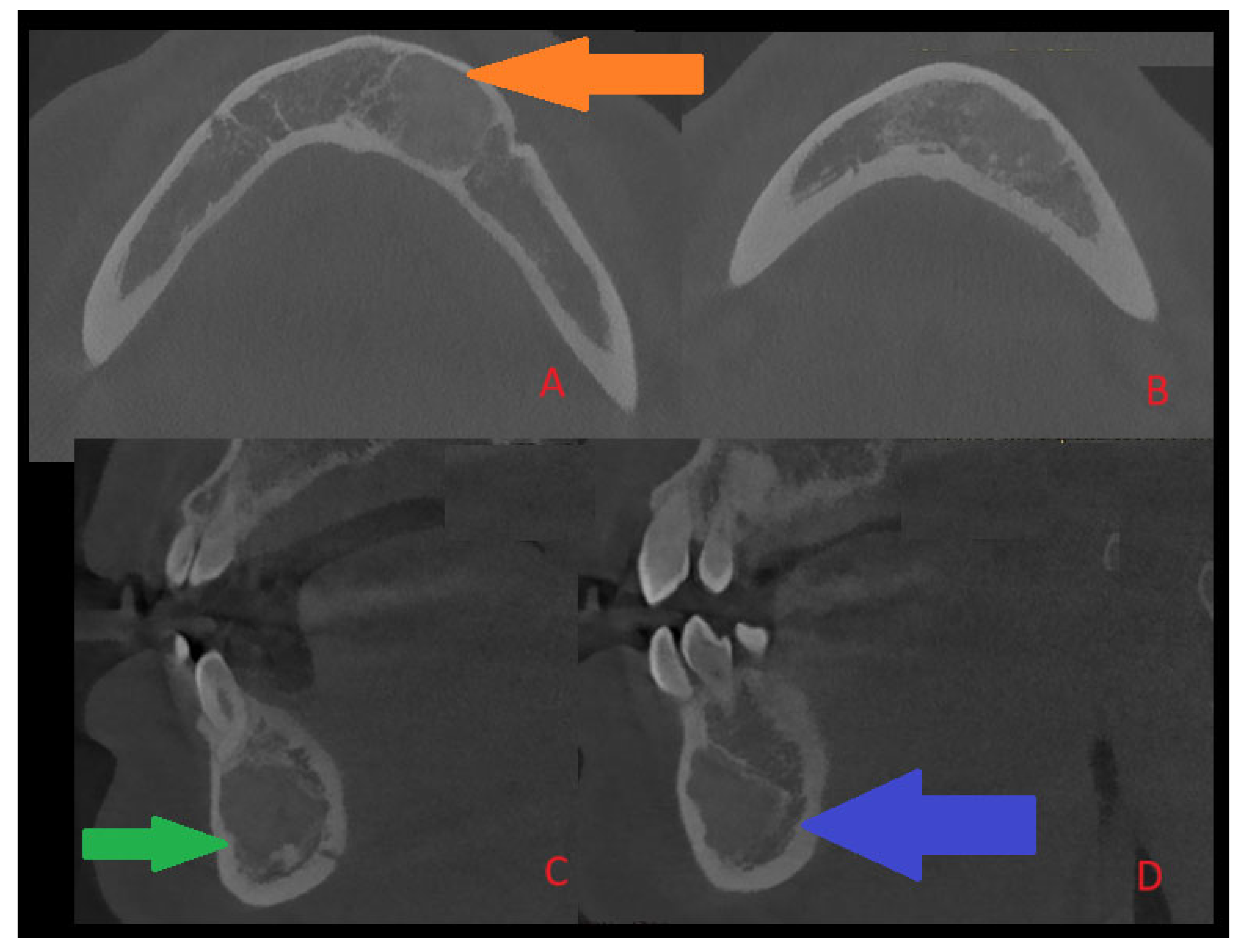 Diagnostics 15 02312 g002 Diagnostics 15 02312 g002