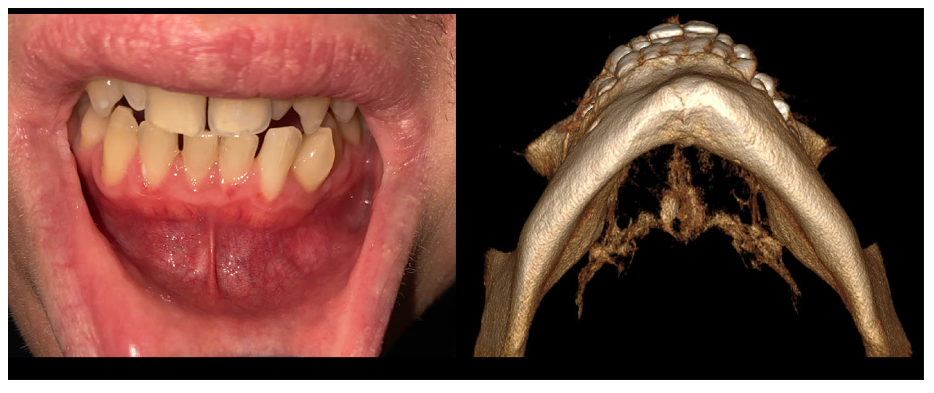 Diagnostics 15 02312 g003 Diagnostics 15 02312 g003