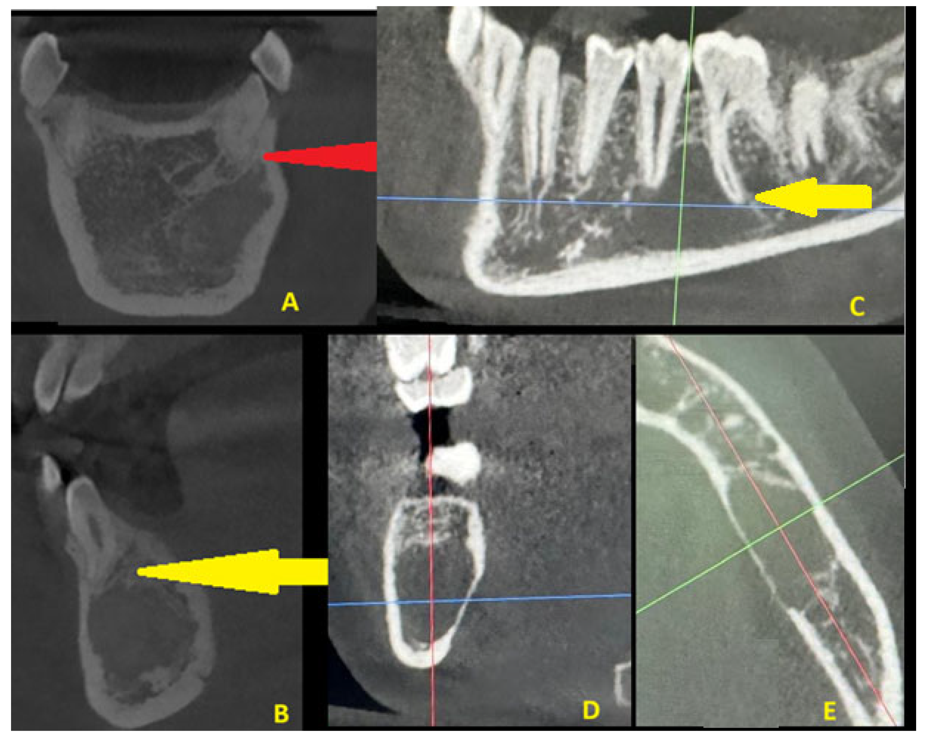 Diagnostics 15 02312 g005 Diagnostics 15 02312 g005