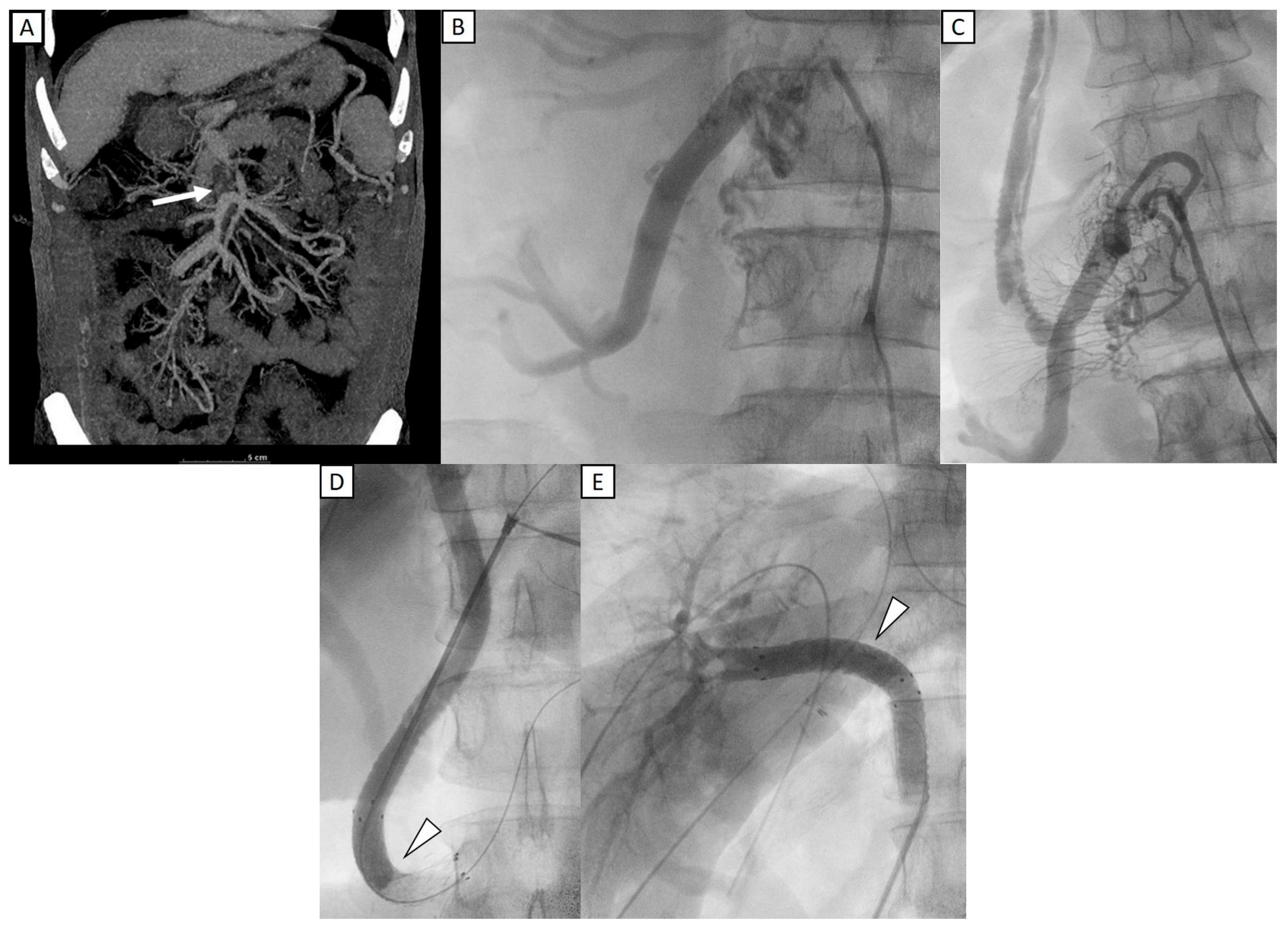 Diagnostics 15 02321 g002 Diagnostics 15 02321 g002