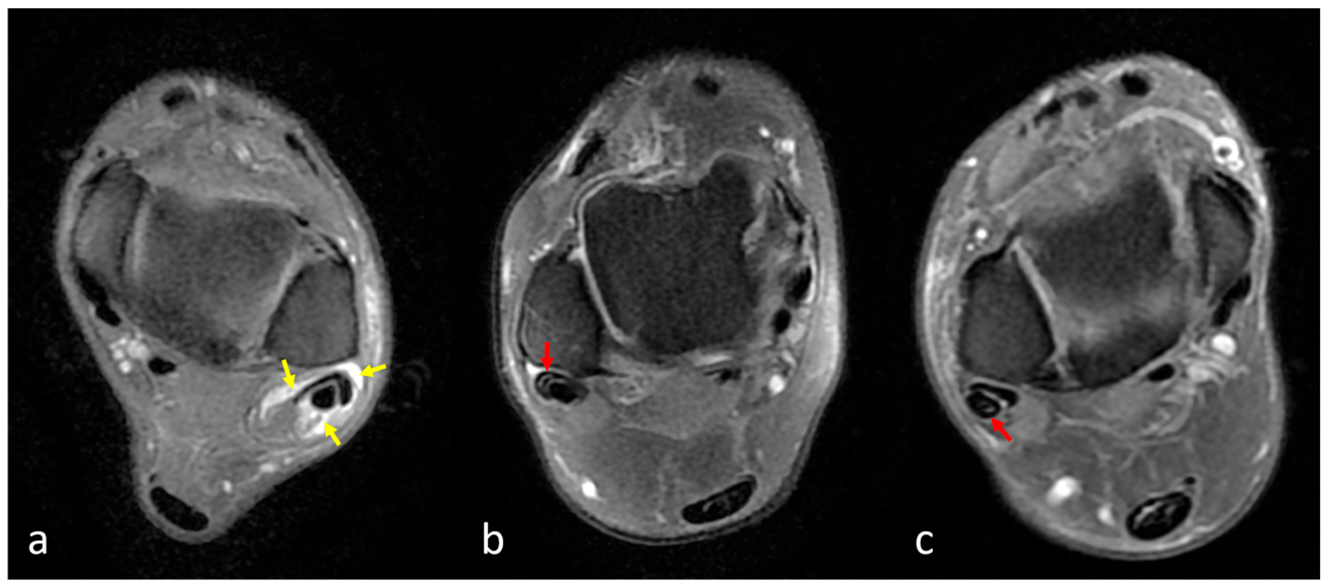 Diagnostics 15 02329 g003 Diagnostics 15 02329 g003