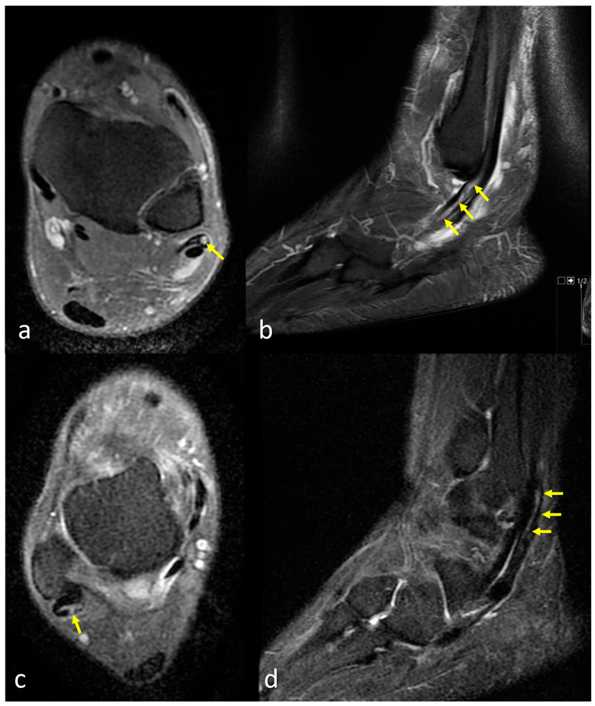 Diagnostics 15 02329 g004 Diagnostics 15 02329 g004