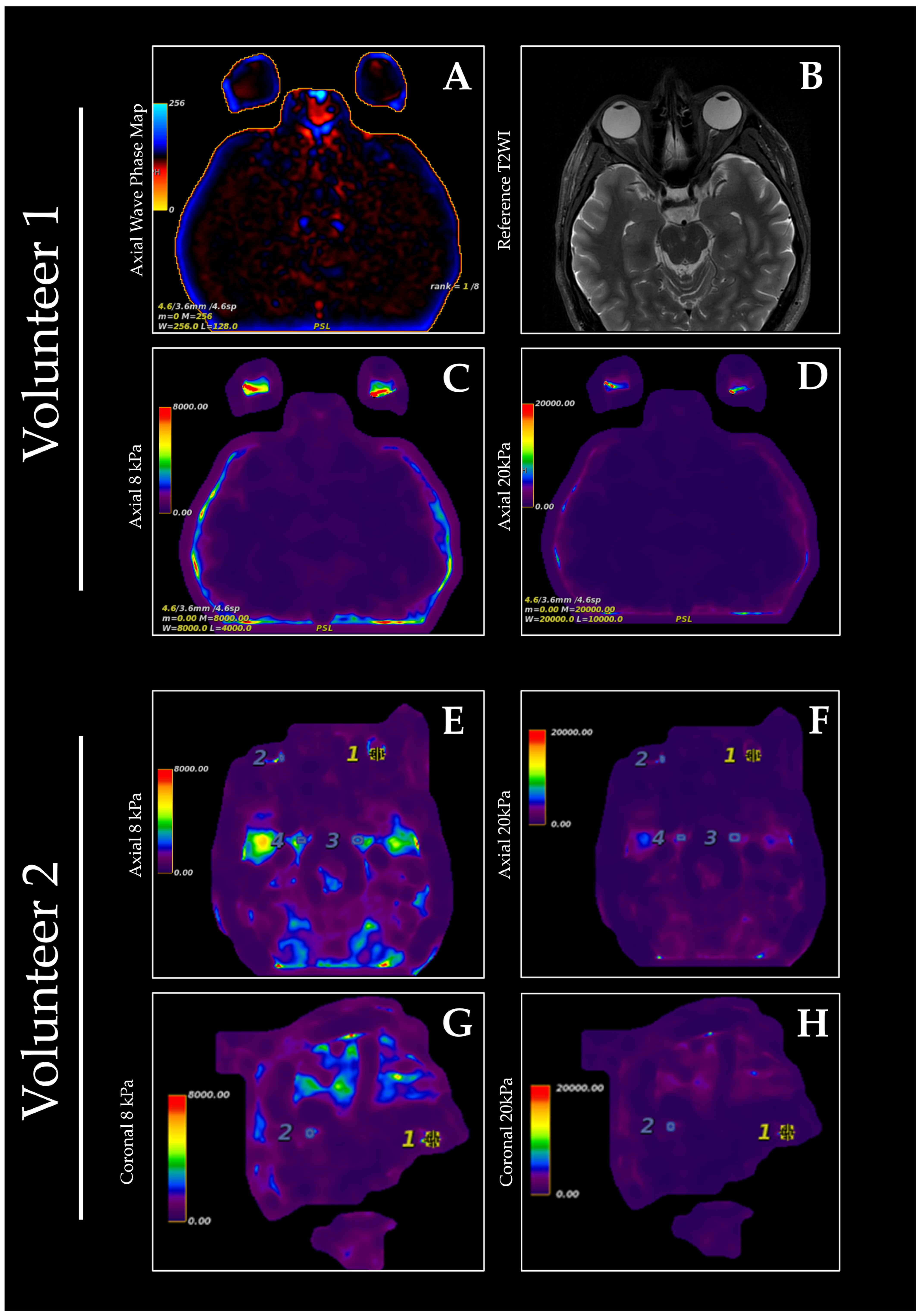 Diagnostics 15 02342 g001 Diagnostics 15 02342 g001