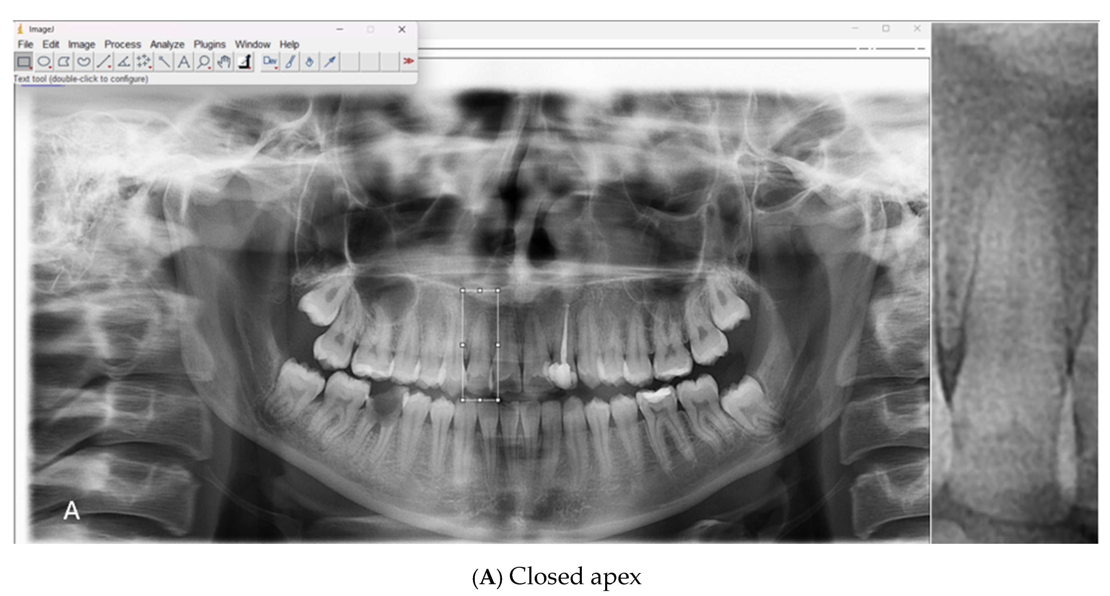 Diagnostics 15 02350 g001a