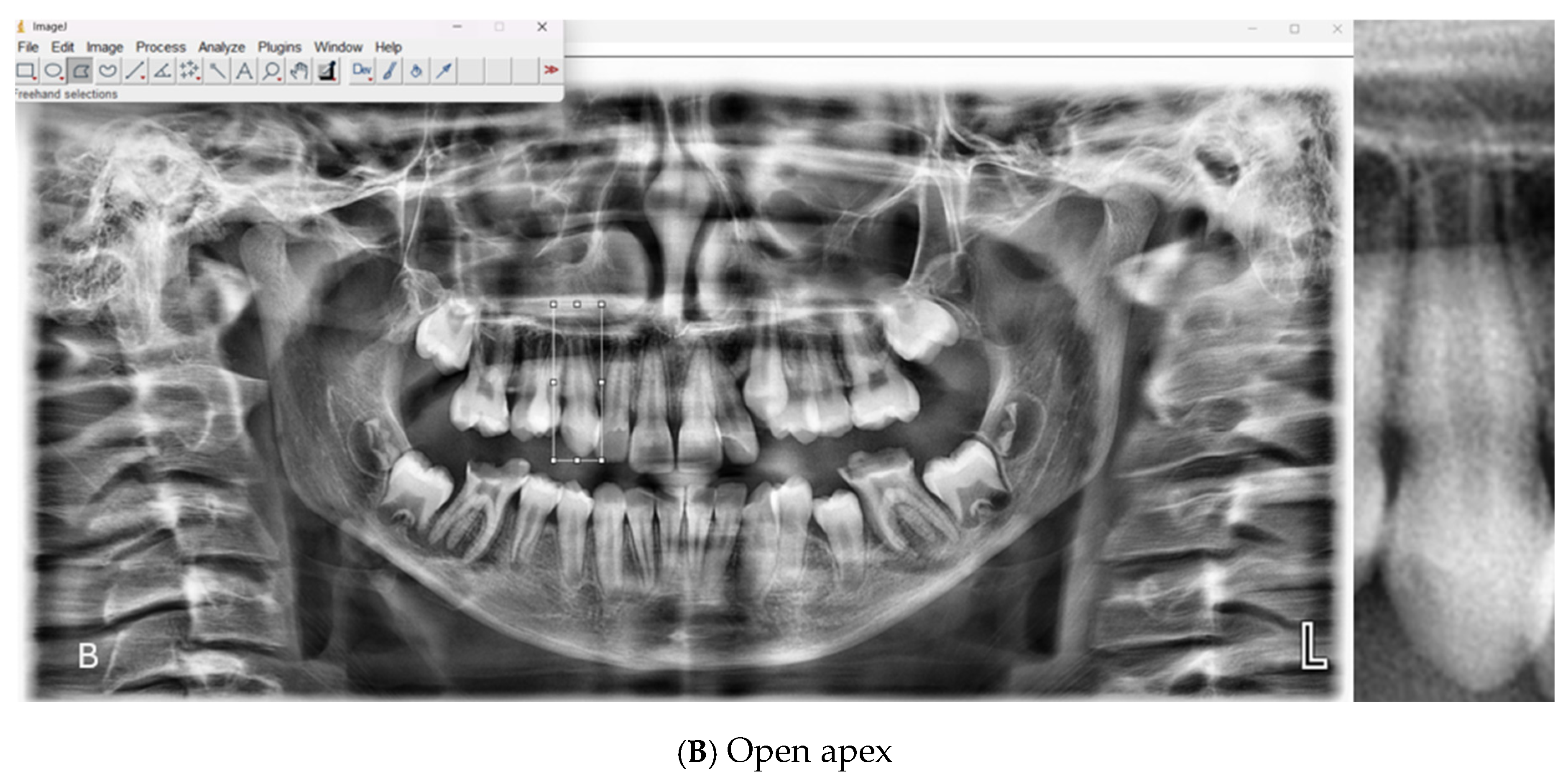 Diagnostics 15 02350 g001b