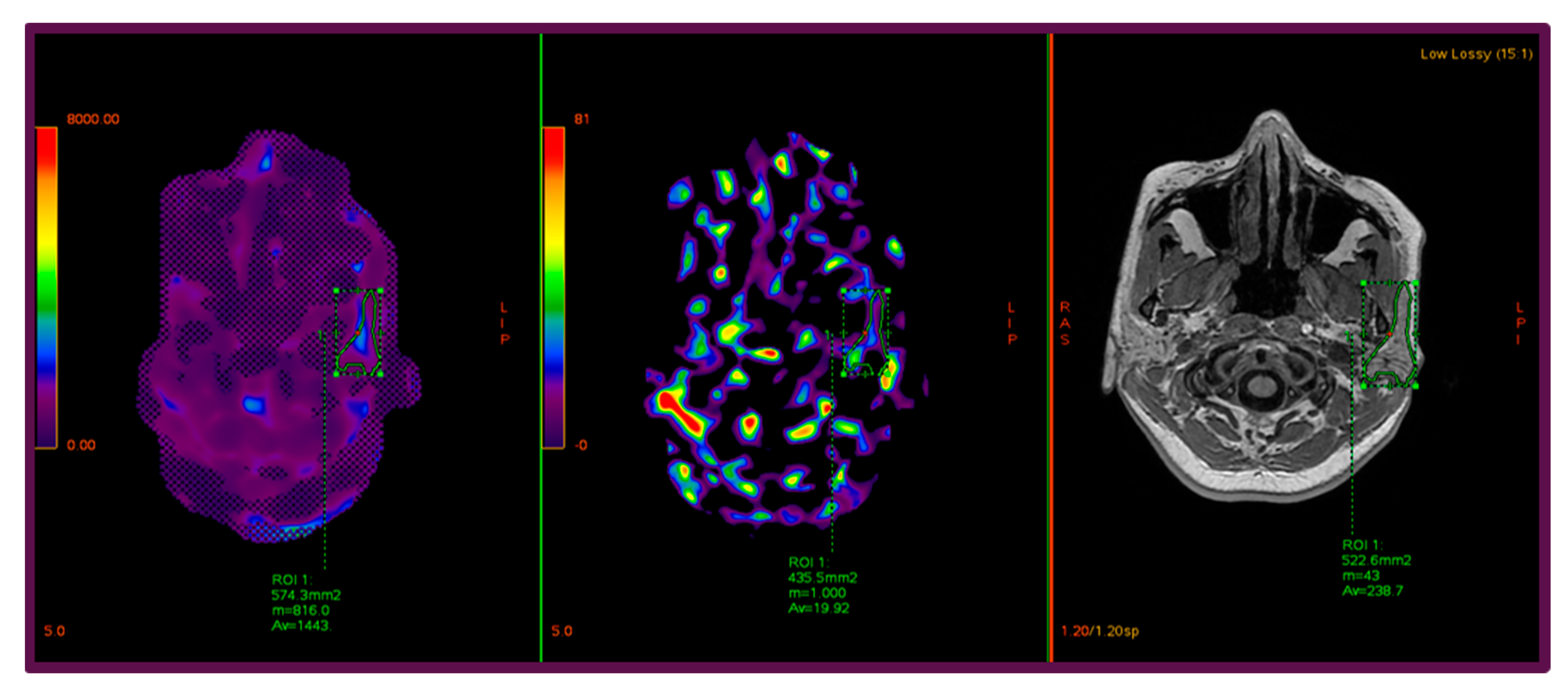 Diagnostics 15 02351 g002 Diagnostics 15 02351 g002