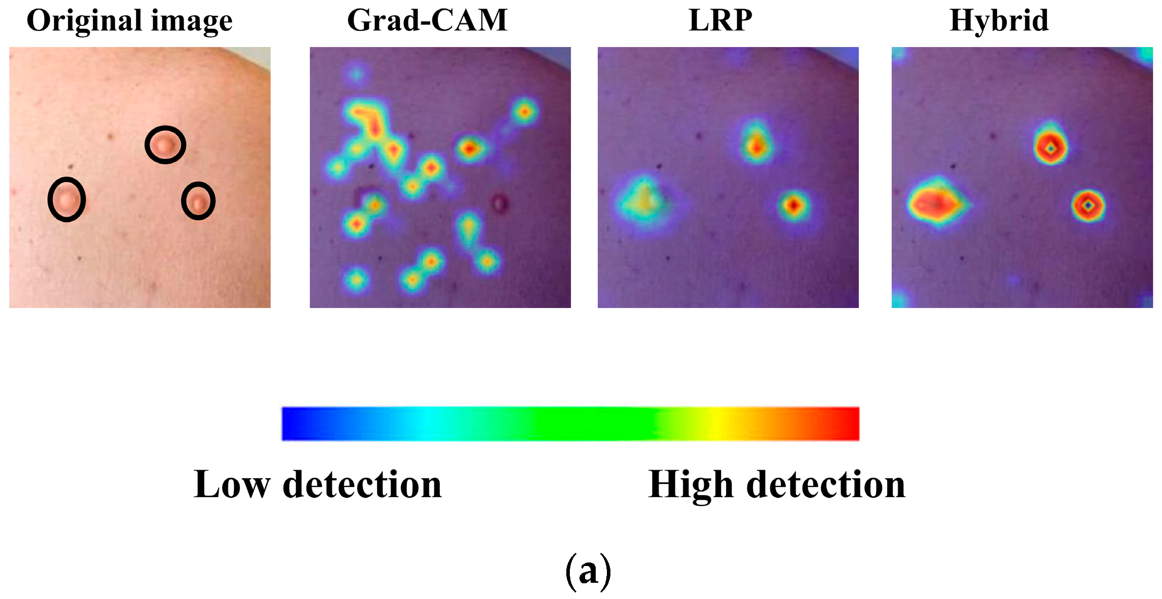 Diagnostics 15 02354 g005a Diagnostics 15 02354 g005a