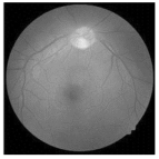 Diagnostics 15 02355 i003