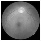 Diagnostics 15 02355 i004