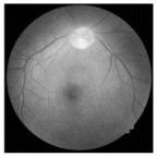 Diagnostics 15 02355 i005