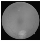 Diagnostics 15 02355 i006