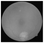 Diagnostics 15 02355 i007