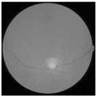 Diagnostics 15 02355 i012