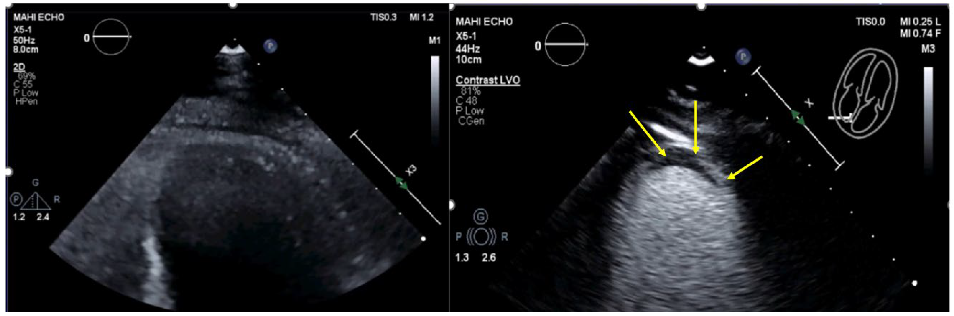 Diagnostics 15 02371 g004