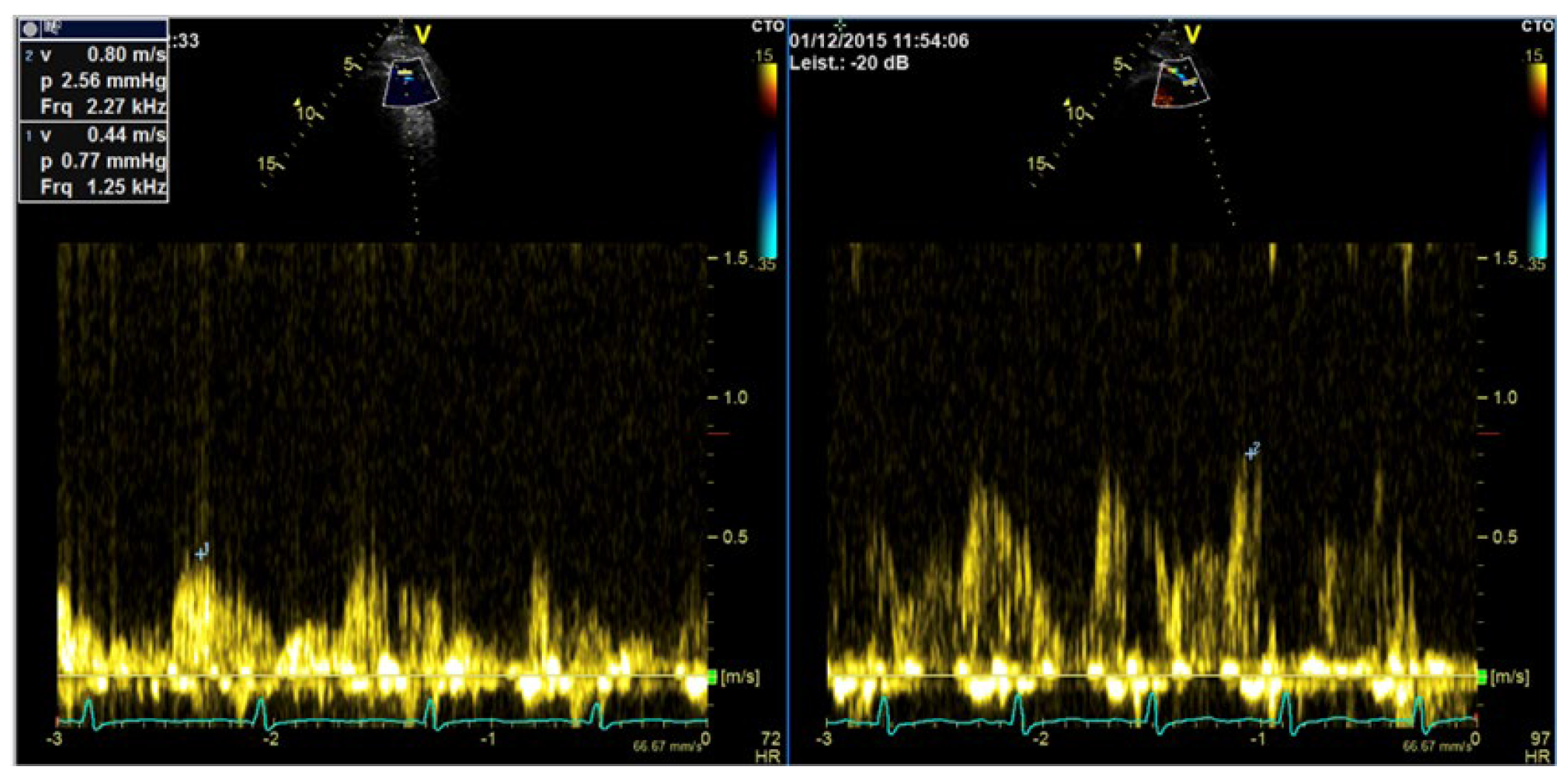 Diagnostics 15 02371 g012