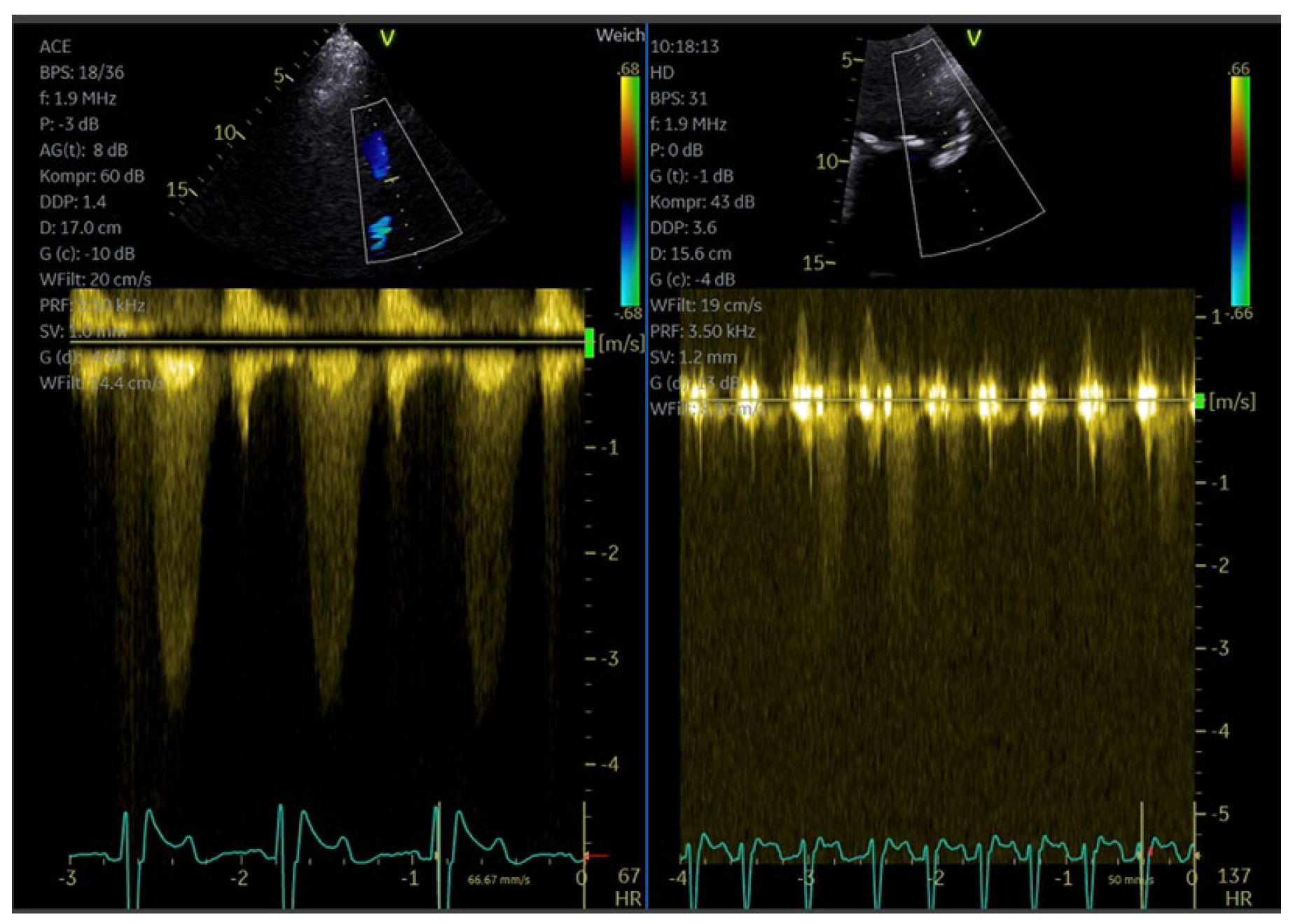 Diagnostics 15 02371 g013