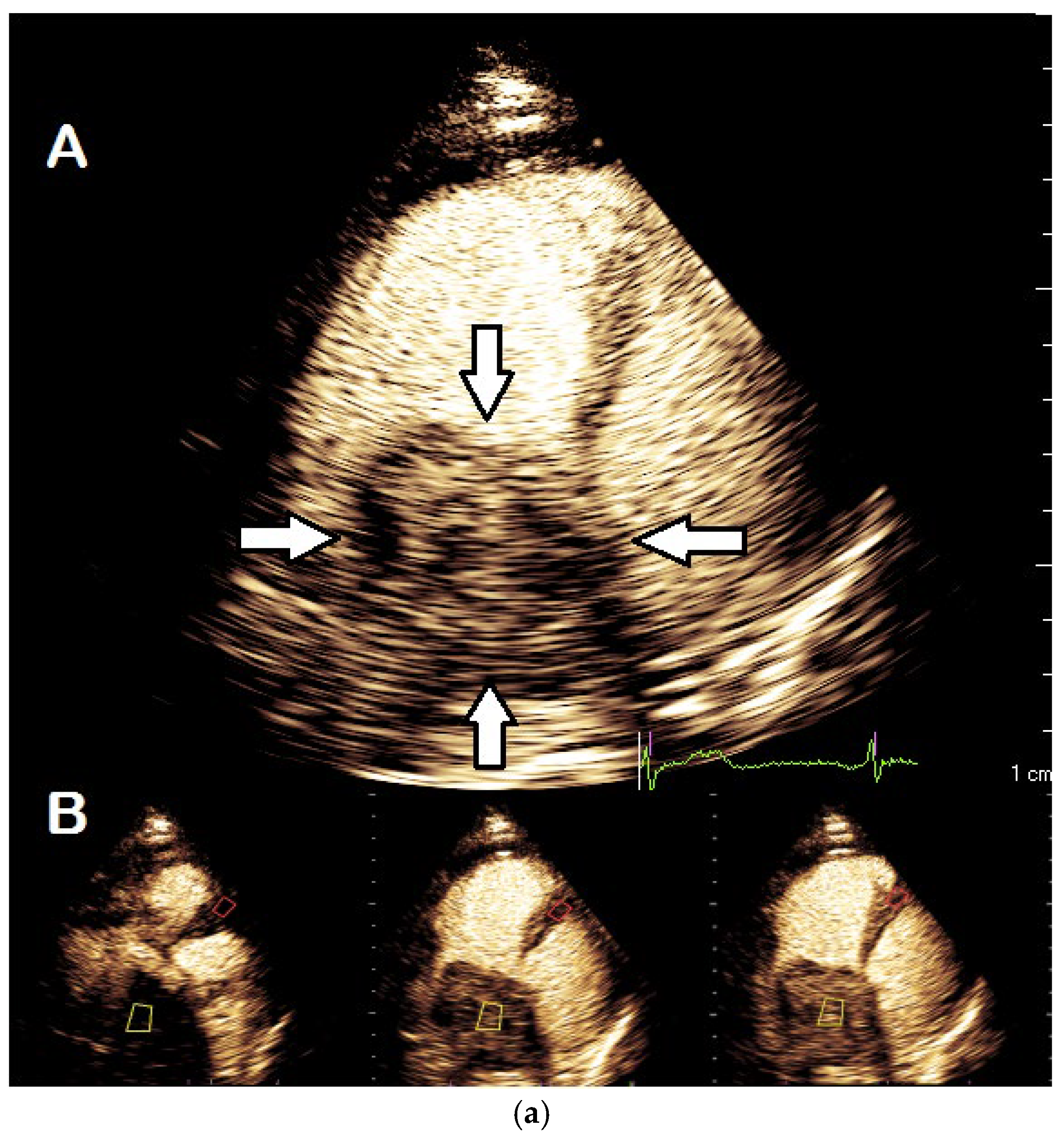 Diagnostics 15 02371 g016a