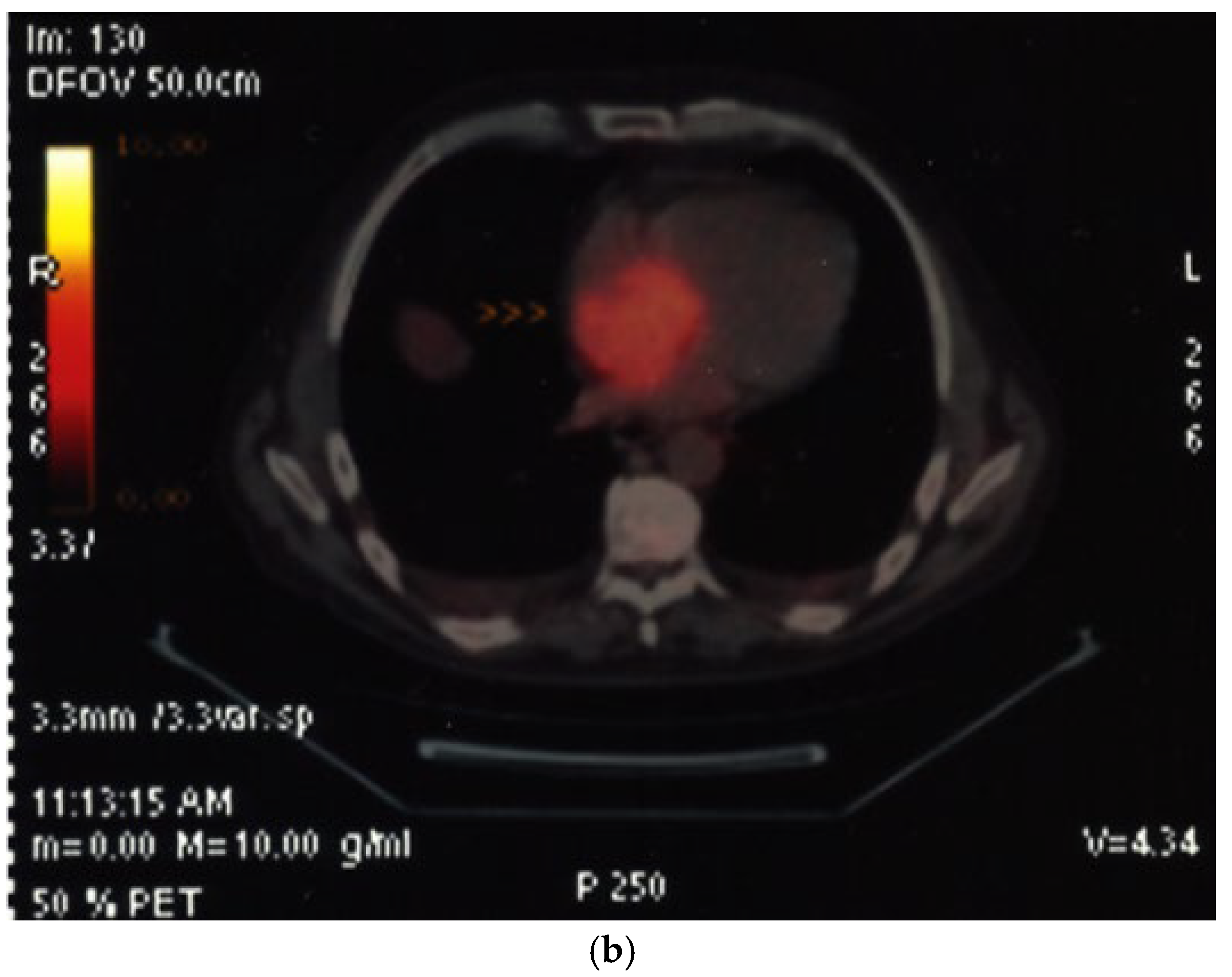 Diagnostics 15 02371 g016b