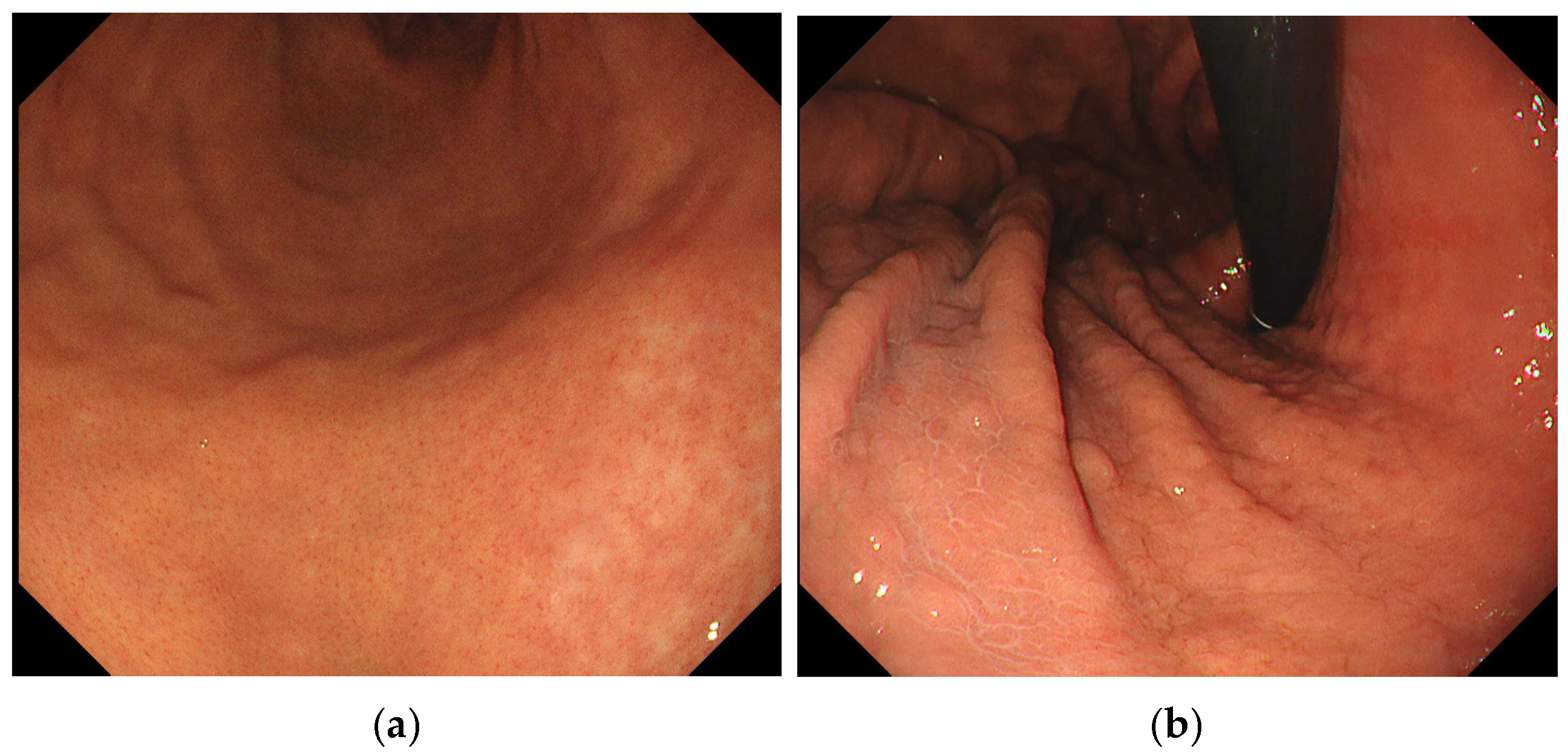 Diagnostics 15 02376 g002 Diagnostics 15 02376 g002