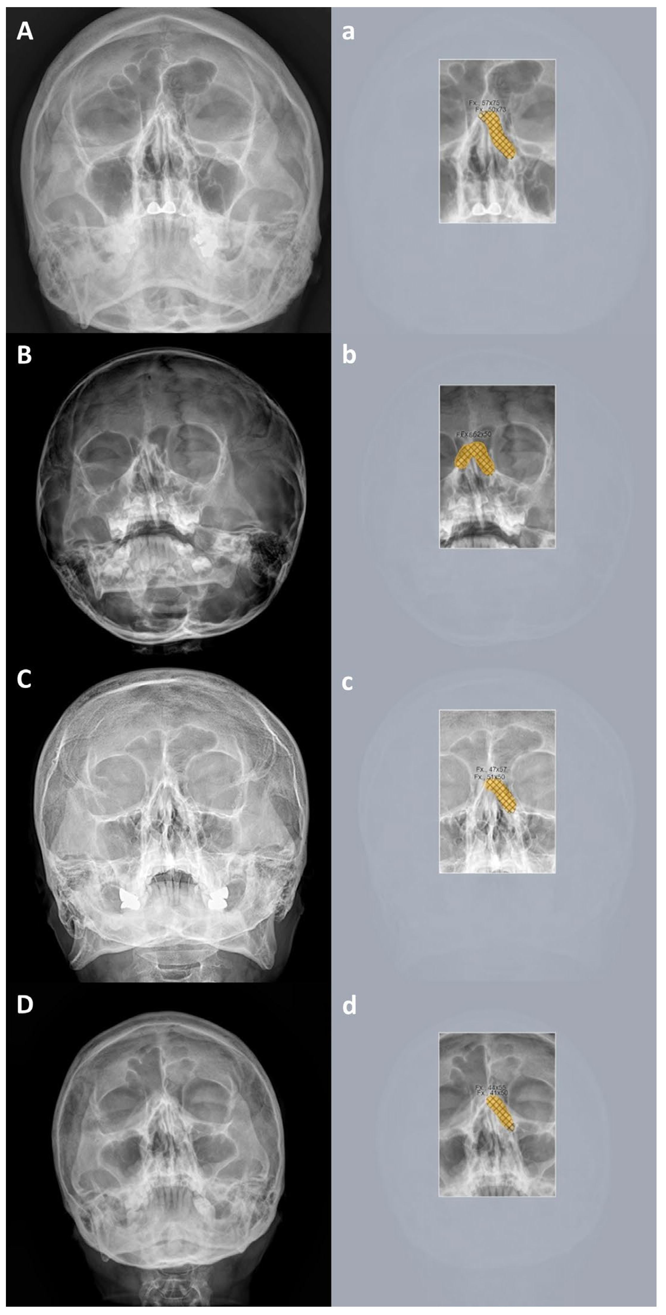 Diagnostics 15 02386 g009 Diagnostics 15 02386 g009