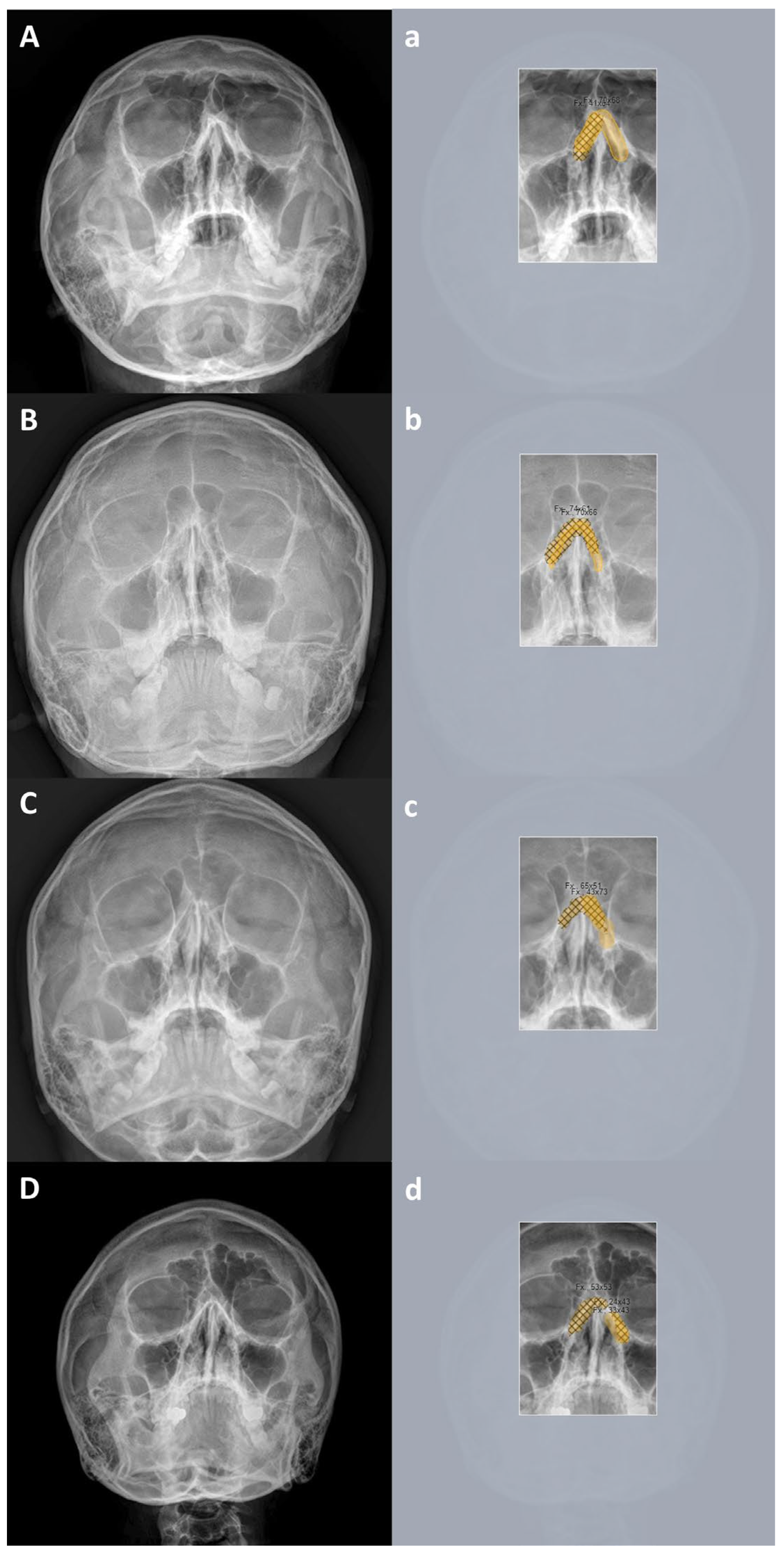 Diagnostics 15 02386 g010 Diagnostics 15 02386 g010