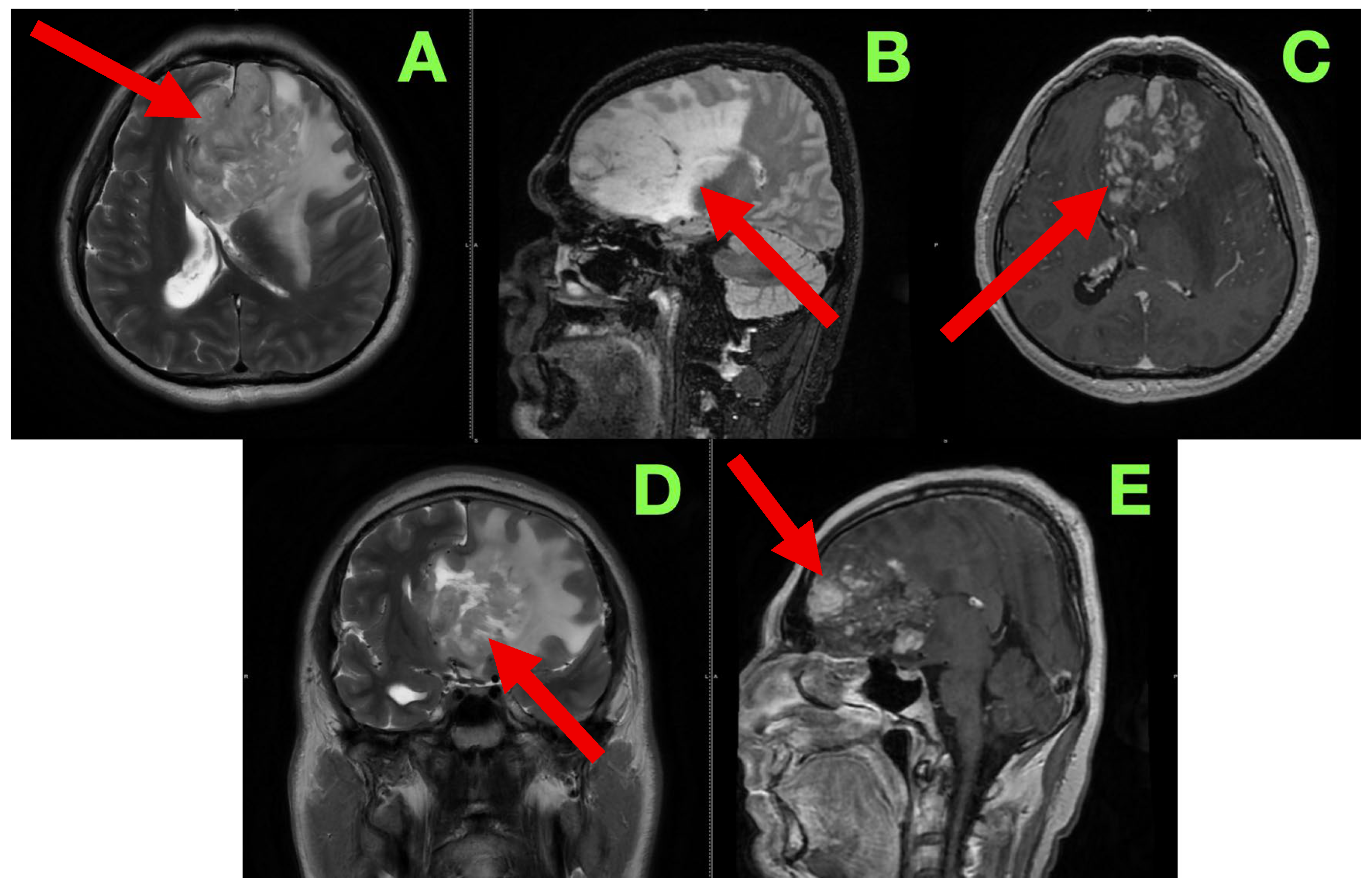 Diagnostics 15 02393 g001