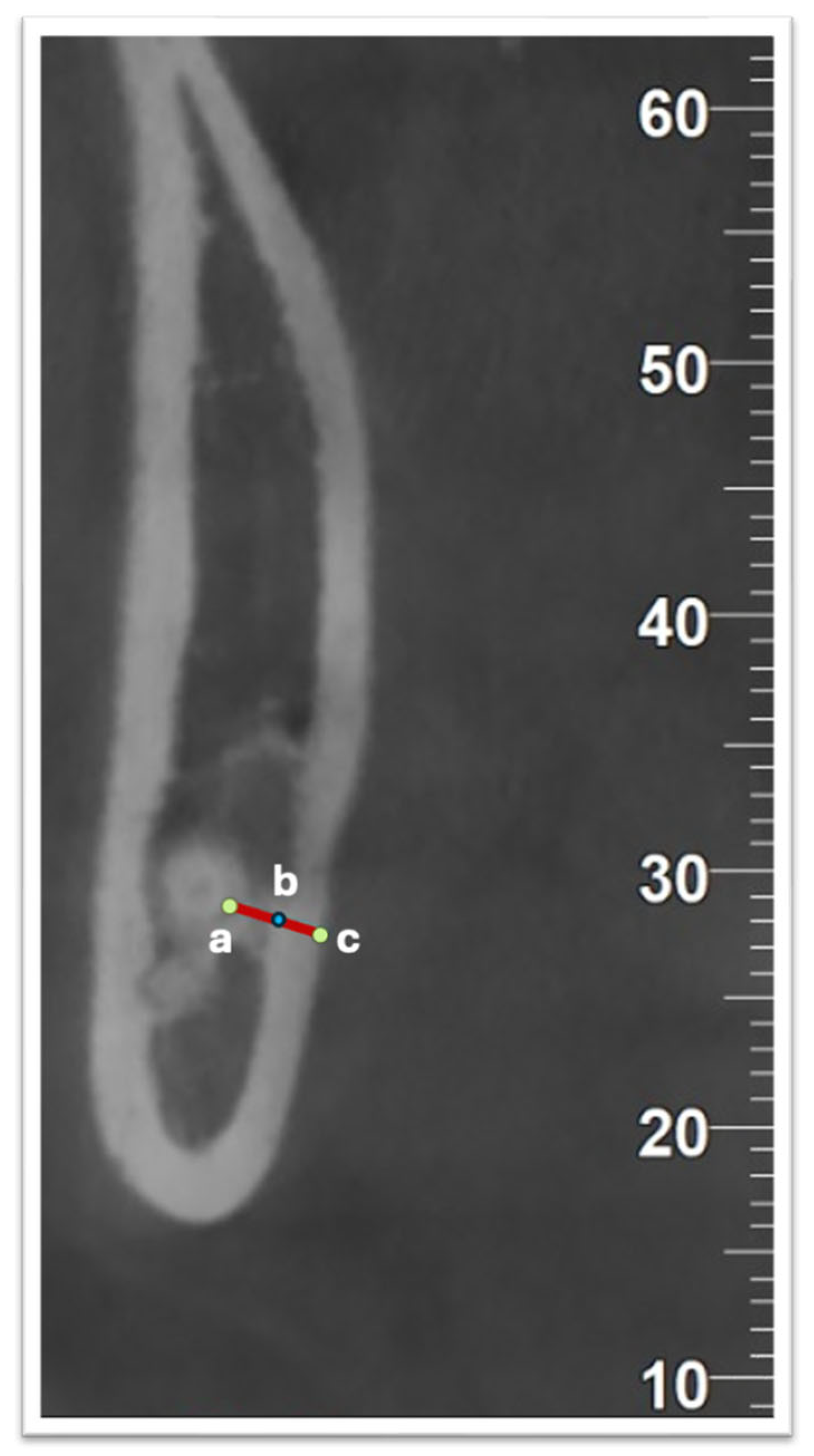 Diagnostics 15 02401 g003 Diagnostics 15 02401 g003