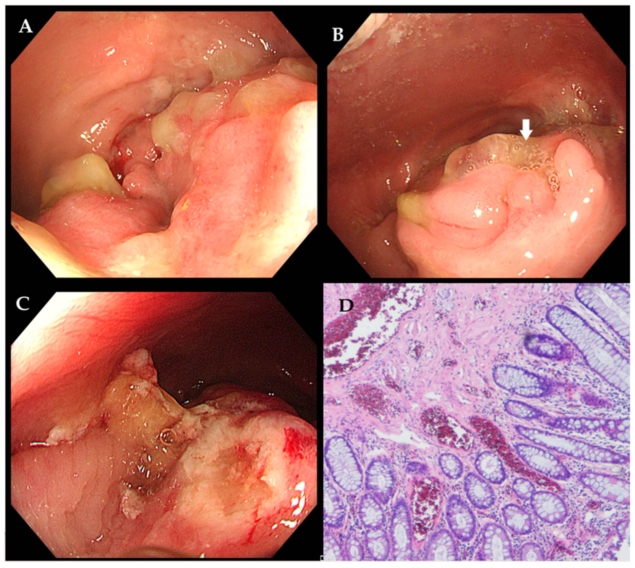 Diagnostics 15 02417 g002 Diagnostics 15 02417 g002