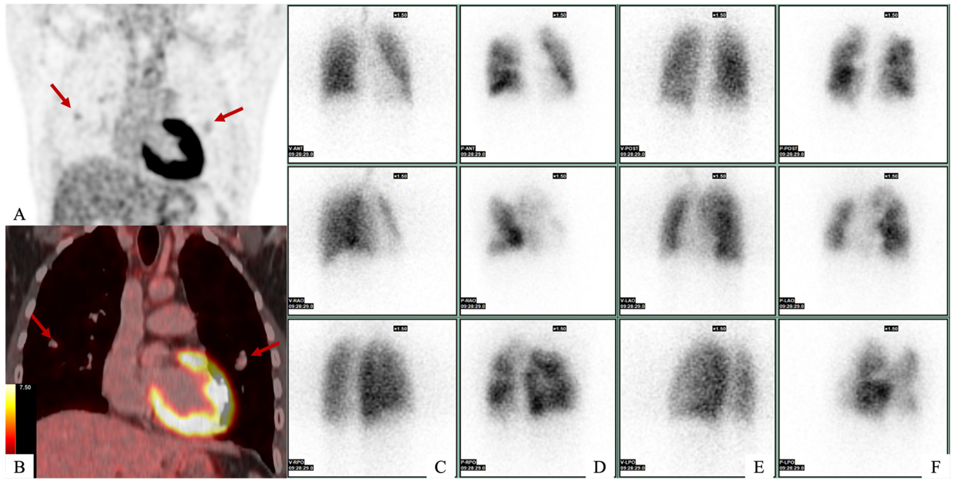 Diagnostics 15 02420 g001 Diagnostics 15 02420 g001
