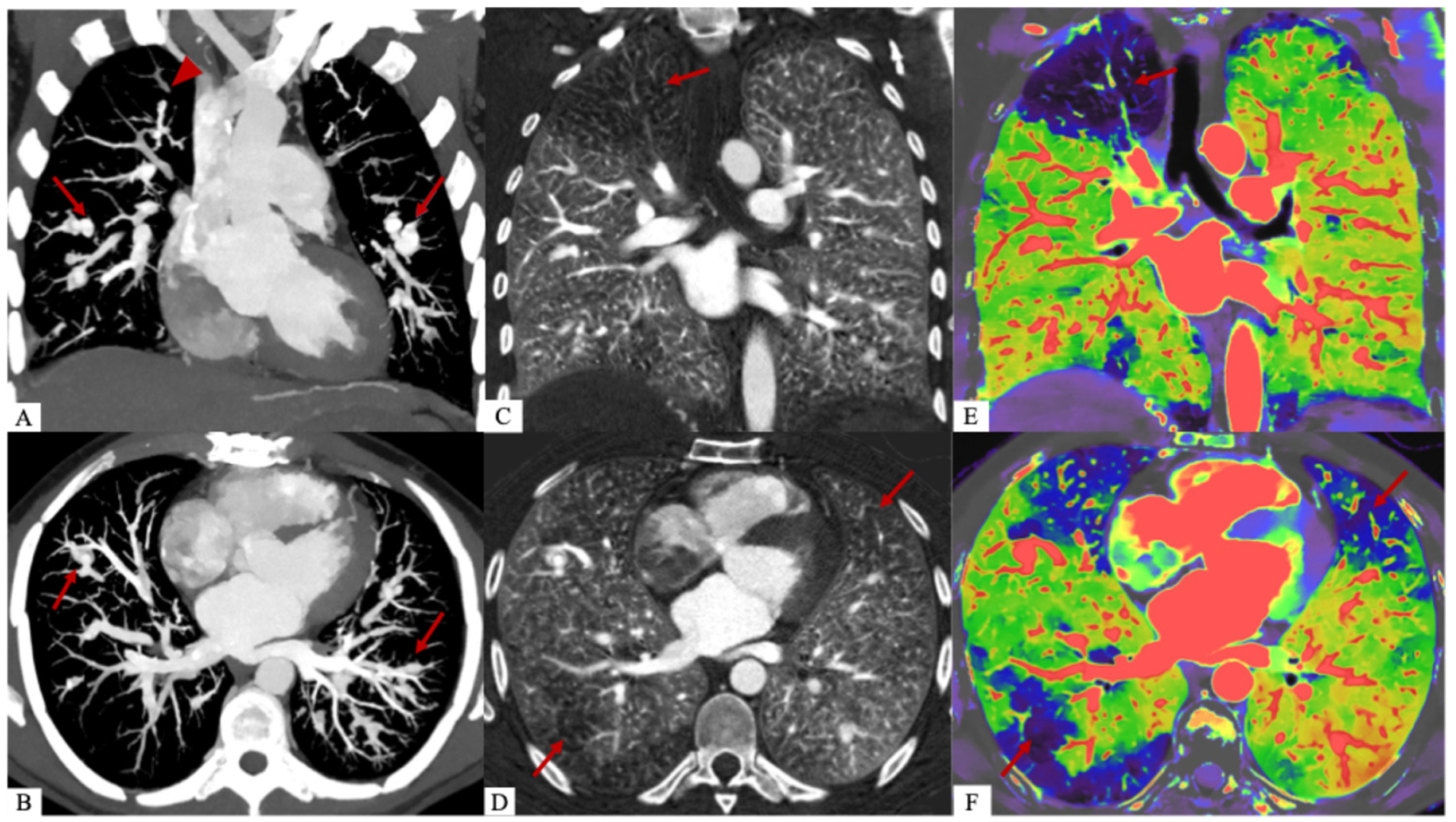 Diagnostics 15 02420 g003 Diagnostics 15 02420 g003