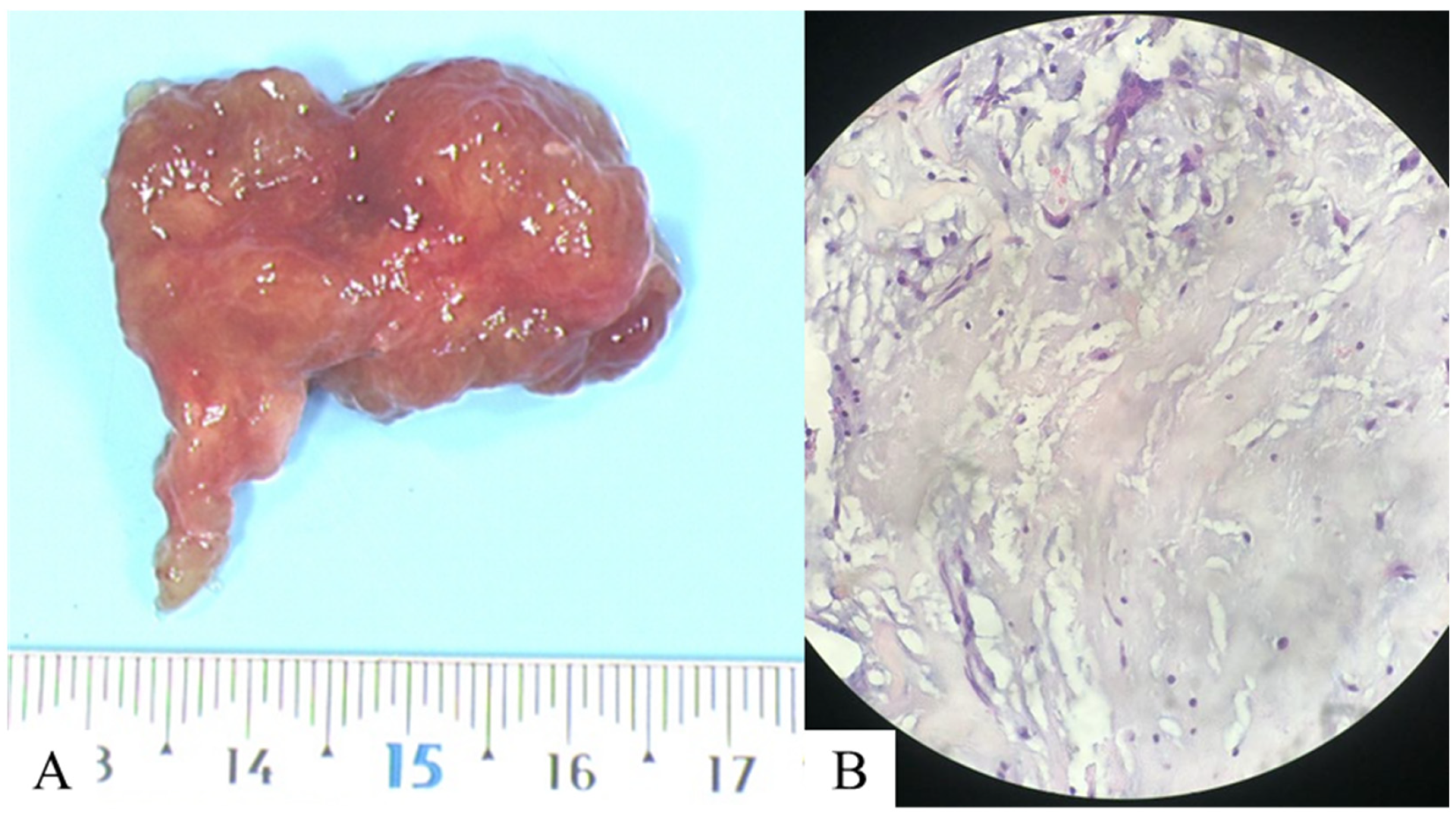 Diagnostics 15 02420 g004 Diagnostics 15 02420 g004