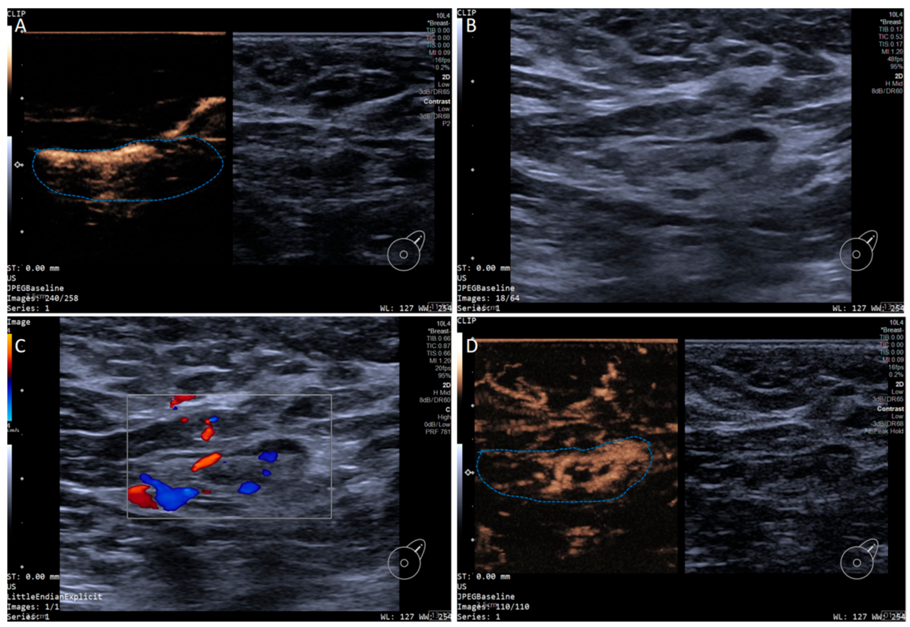 Diagnostics 15 02432 g002