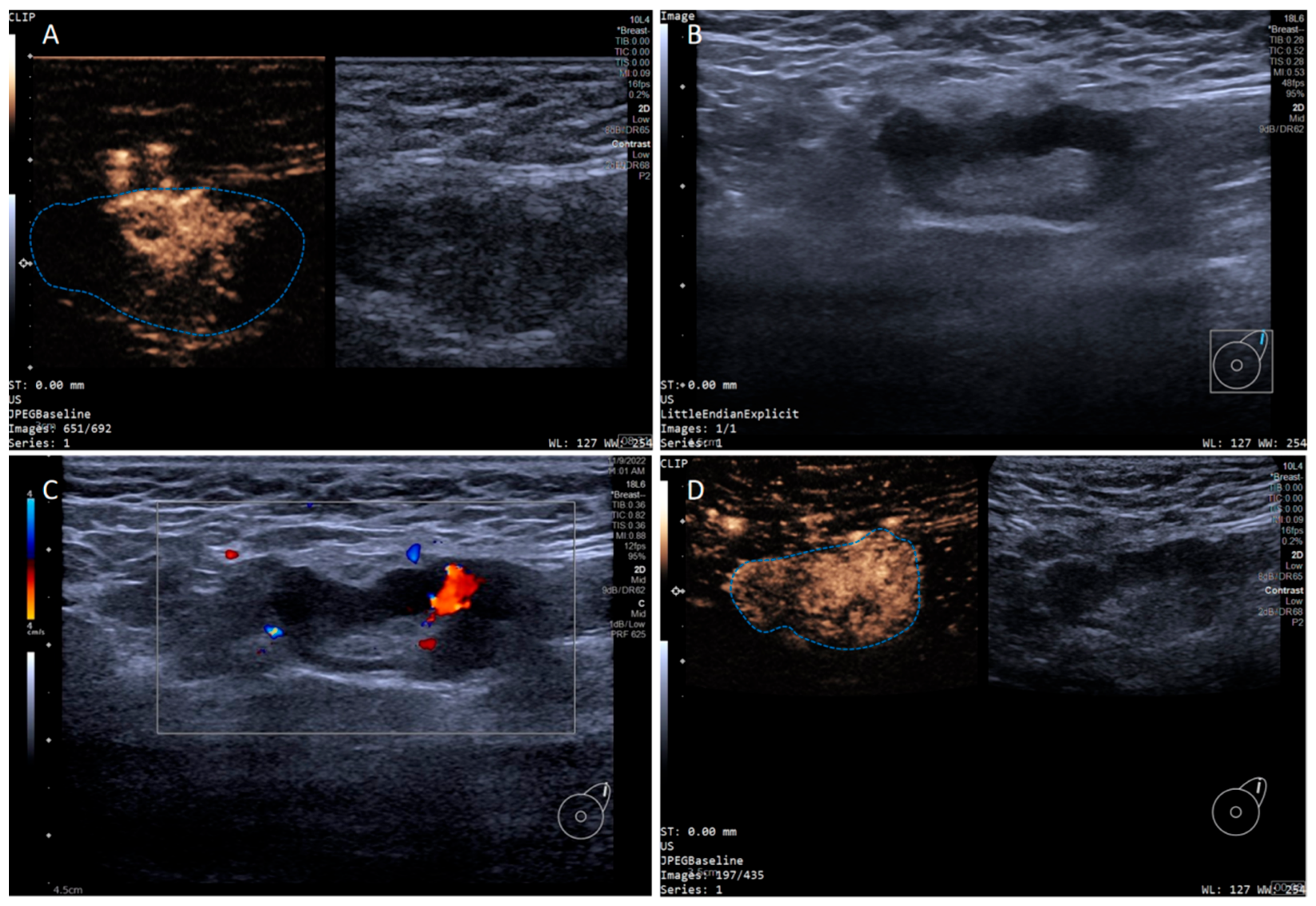 Diagnostics 15 02432 g003