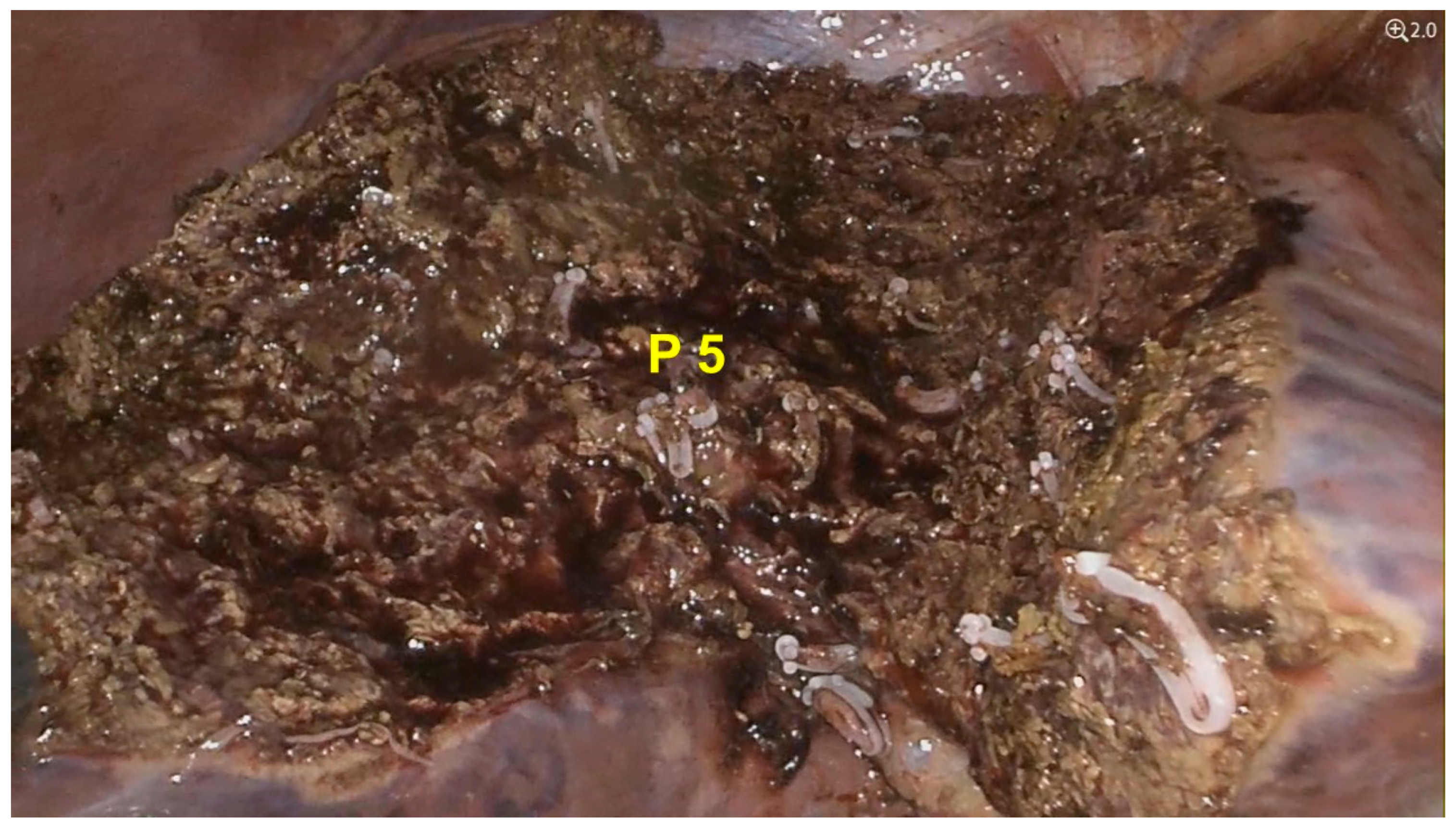 Diagnostics 15 02442 g003 Diagnostics 15 02442 g003